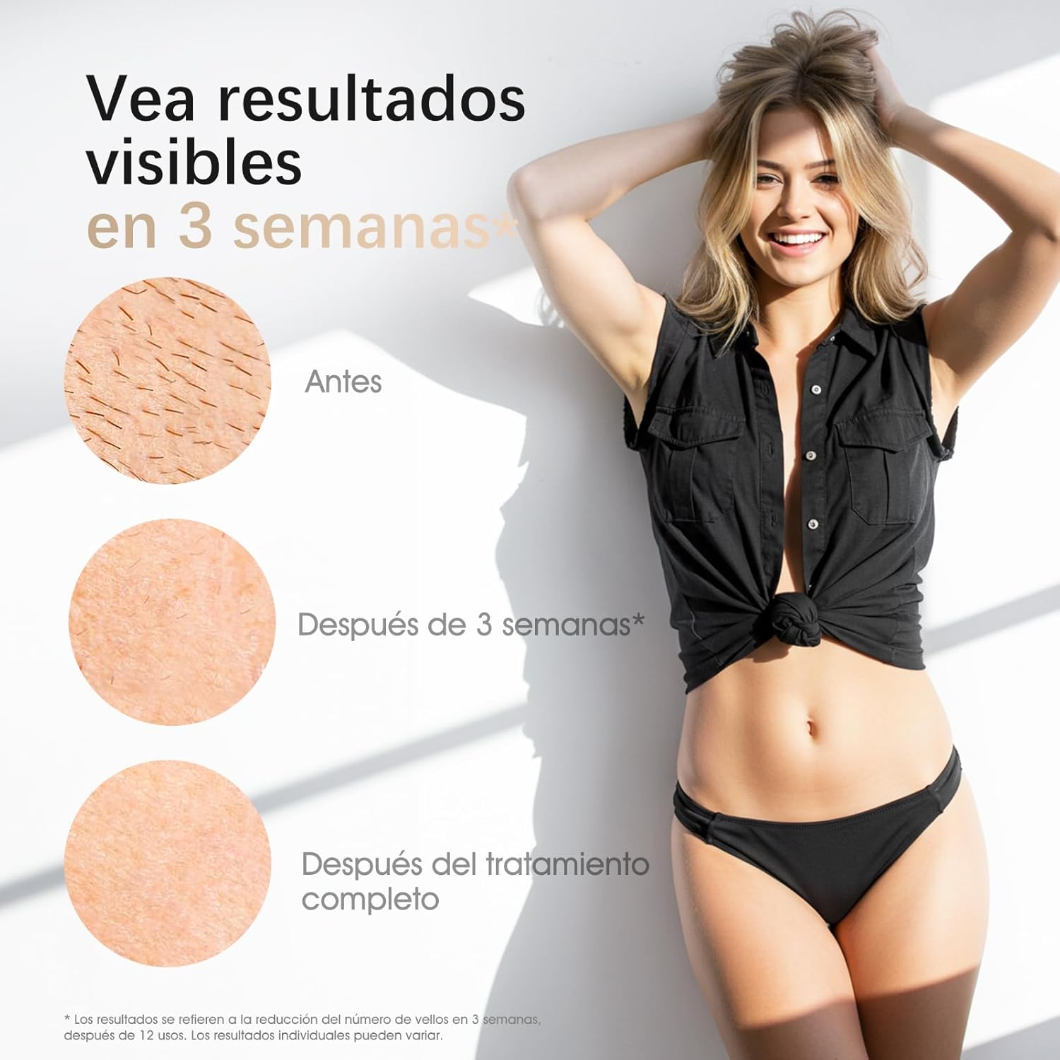 Thumbnail 2 de Haarlosy LCN1201 IPL 999.900 flashes