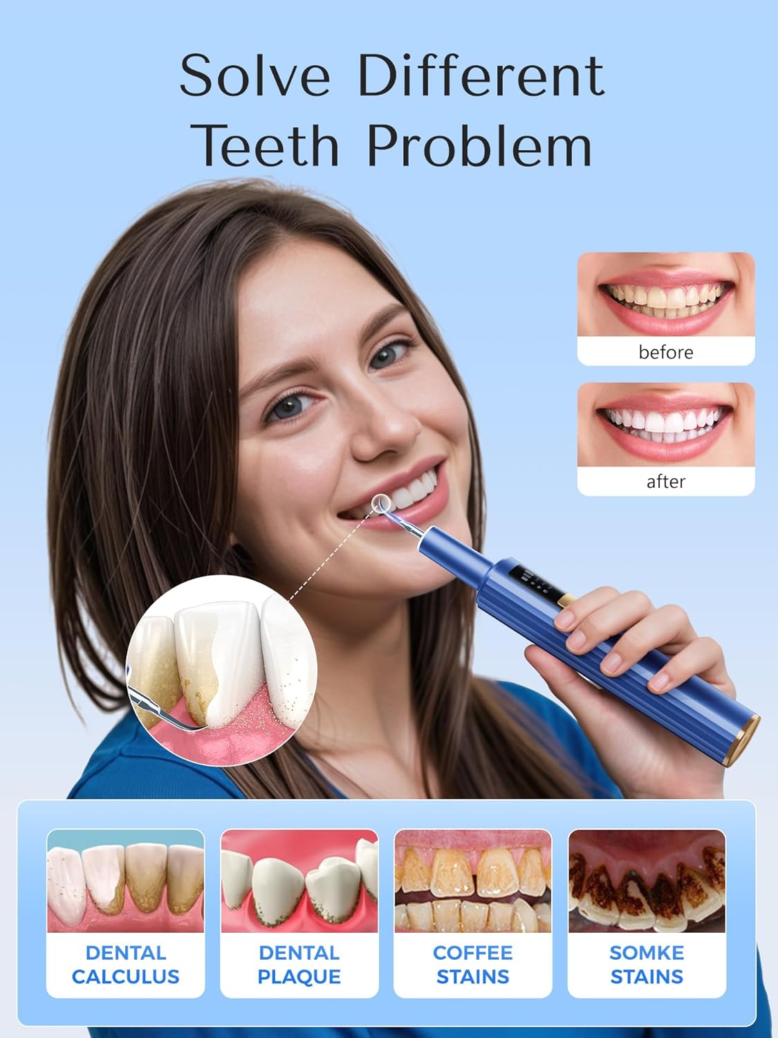 Detalle 2 de Plaque Remover 42kHz 🦷