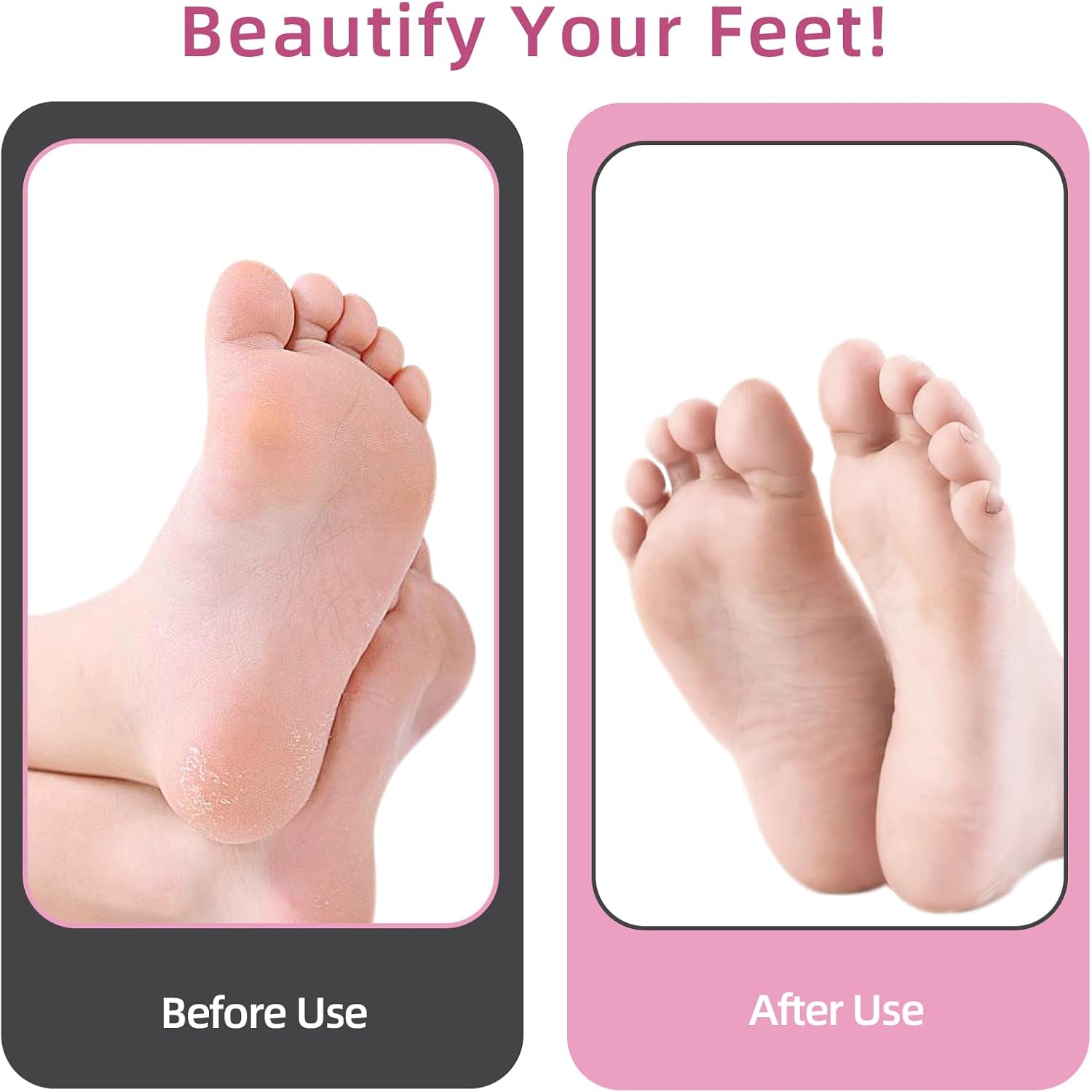 Thumbnail 5 de AprElm 4.8IN Electric Foot Callus Remover with 80 Discs 🦶