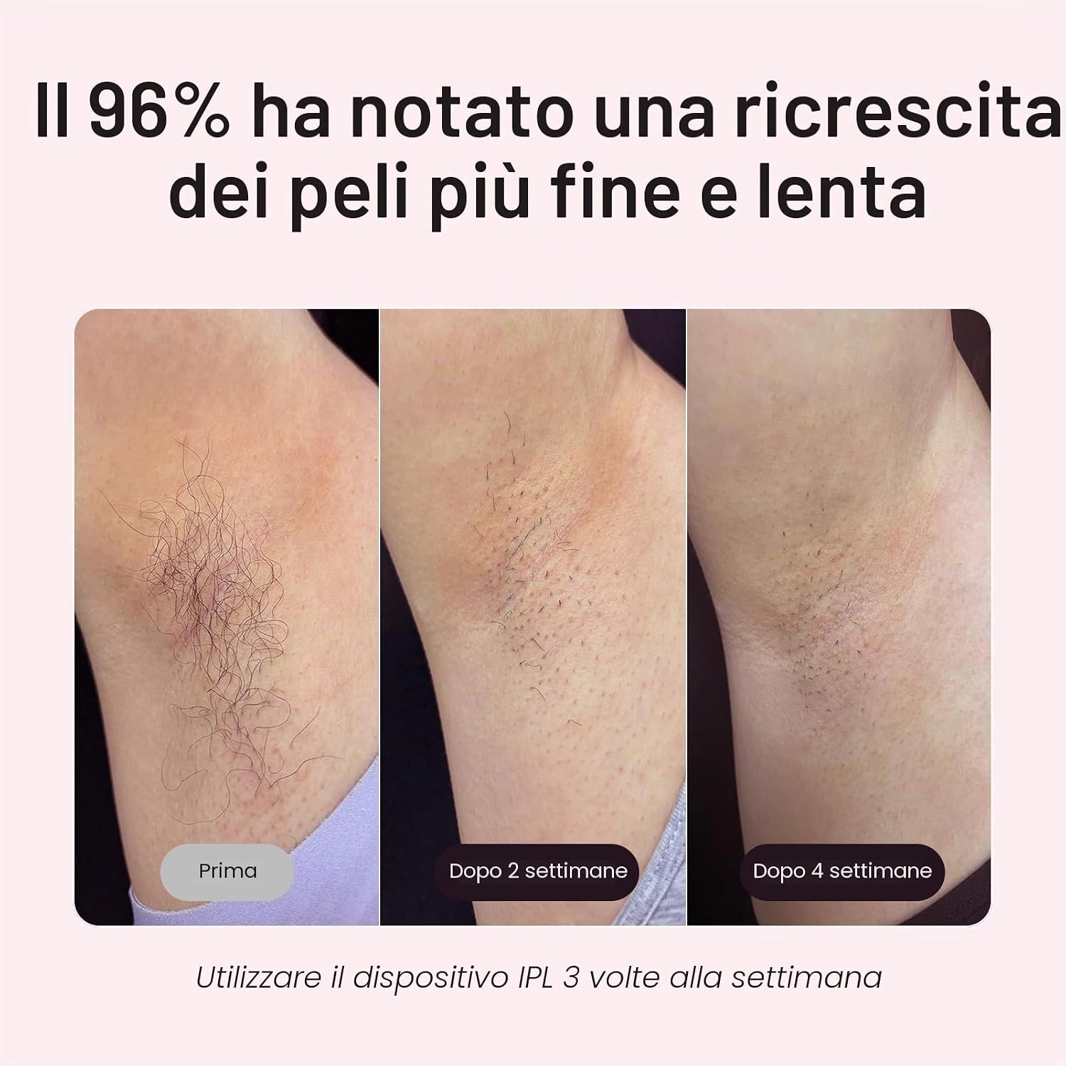 Thumbnail 3 de Wavytalk Epilatore Luce Pulsata IPL 24J – Depilazione Indolore a Casa, Dual-Pulse, Raffreddamento