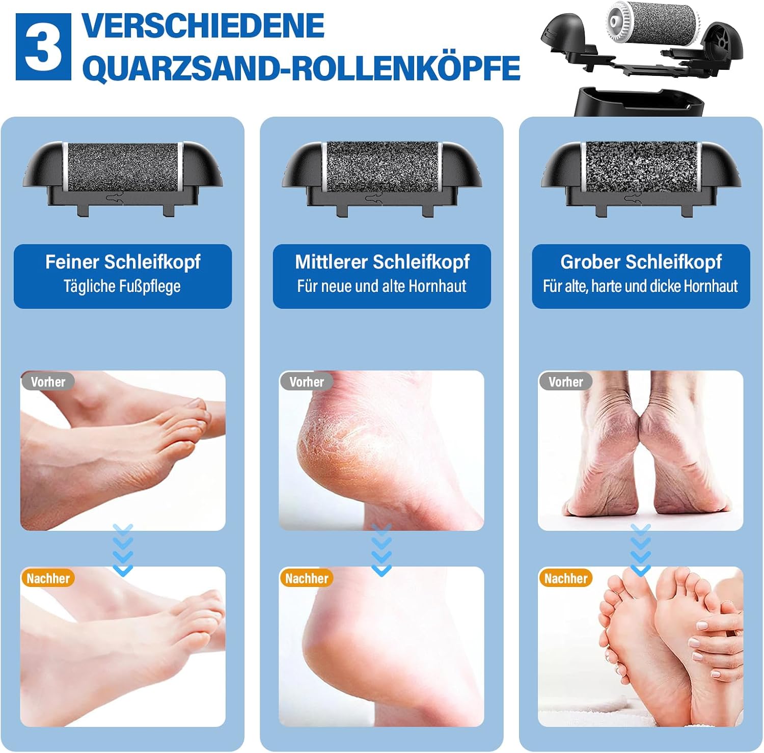 Detalle 2 de Ehomfory Hornhautentferner Elektrisch