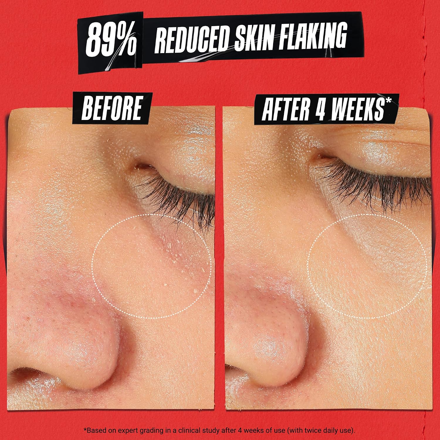 Detalle de Kiehl's Ultra Facial Meltdown Recovery Barrier Cream, 1% Colloidal