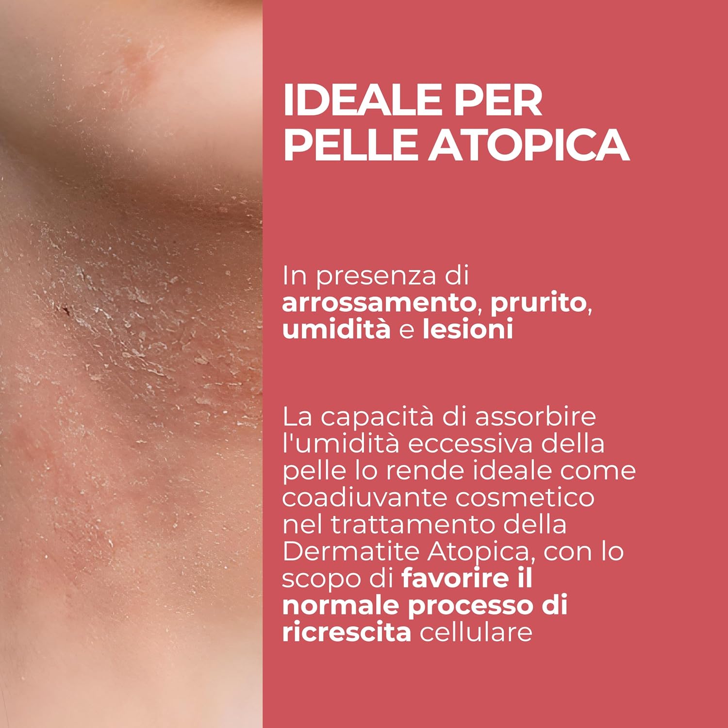 Detalle 2 de MOST - PEG Unguento Viso e Corpo per Bambini e Adulti, Lenitivo e Protettivo (100 ml)