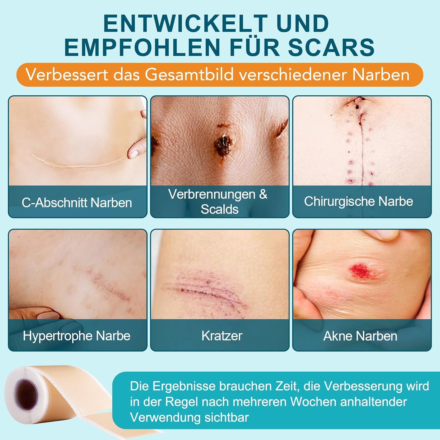 Detalle de Silikonpflaster für Narben (4 cm x 190 cm) – wiederverwendbare Silikon-Narbenblätter für postoperative Wunden, Kaiserschnitt & Verletzungen