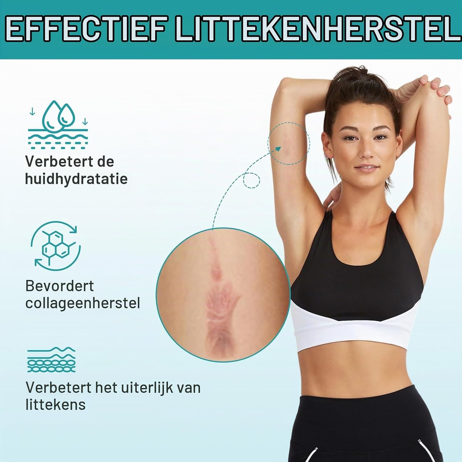 Thumbnail 6 de NVXNMSD siliconen littekentape 152 x 4 cm voor chirurgische littekens