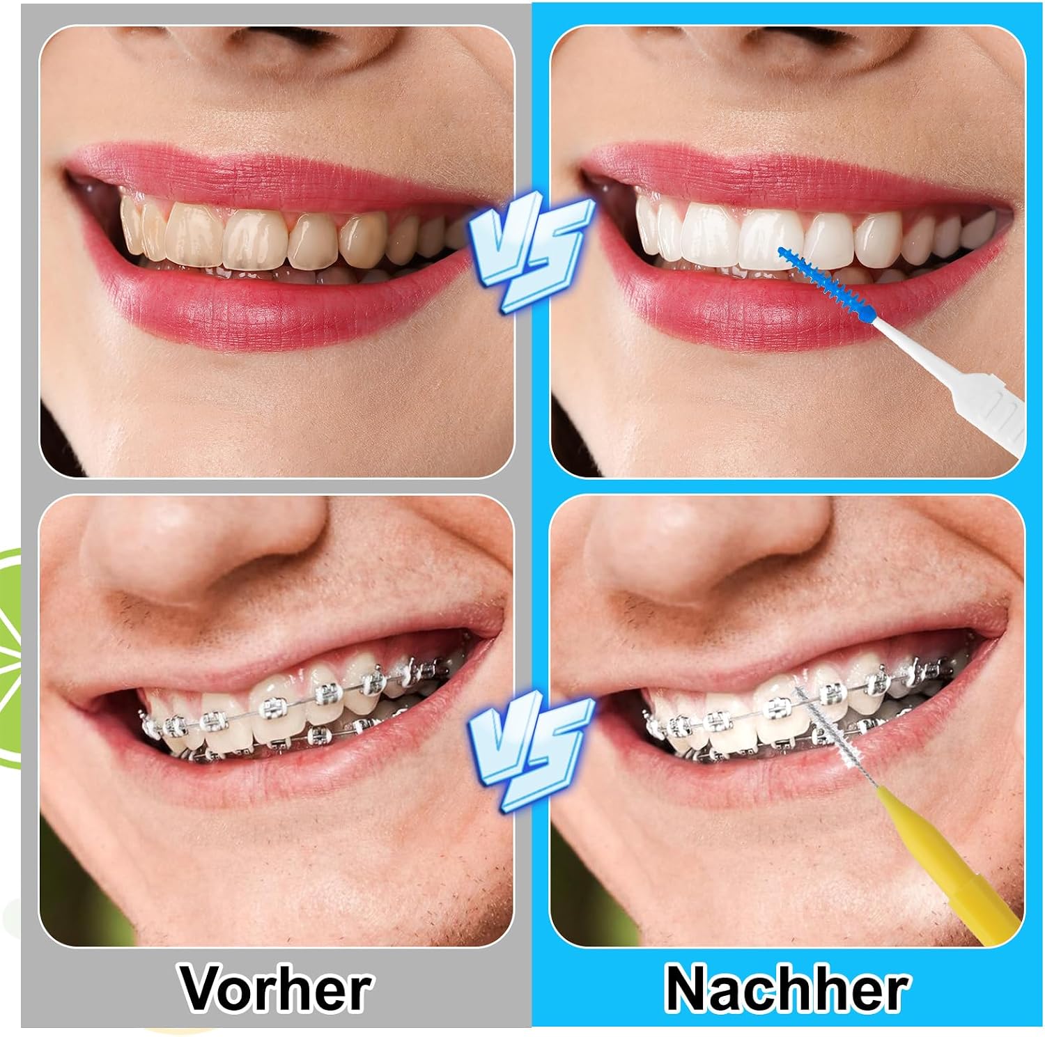 Thumbnail 3 de jjshund Interdentalbürsten Set 255 Stück