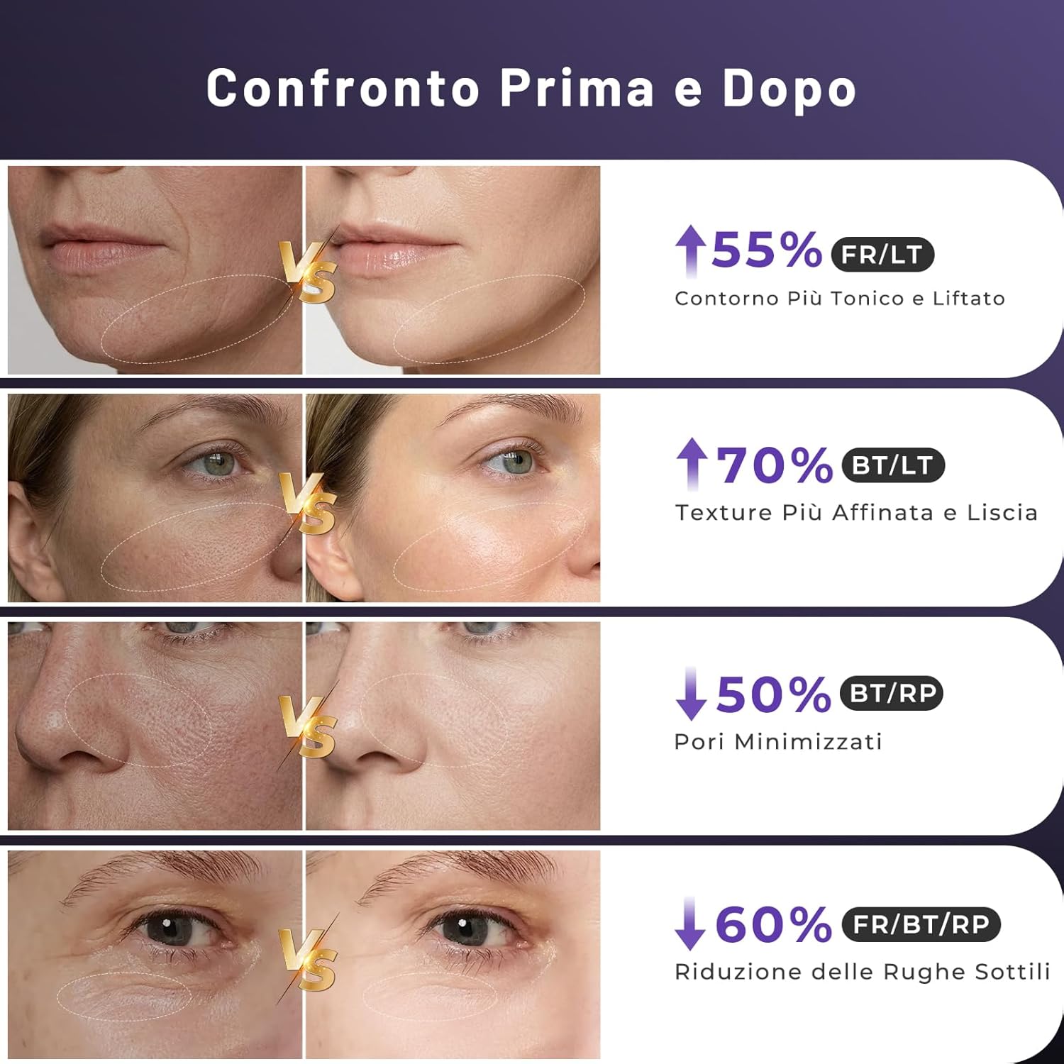 Thumbnail 3 de Radiofrequenza Viso Professionale con Microcorrente e LED – Massaggiatore Viso Viola