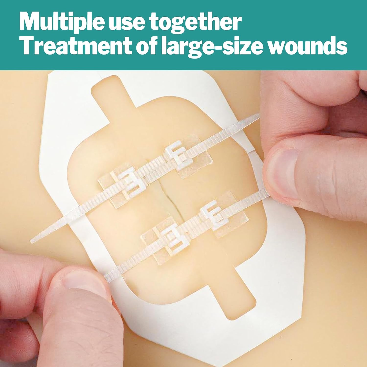 Detalle 2 de AZEN 10 Pack wound closure strips 🩹
