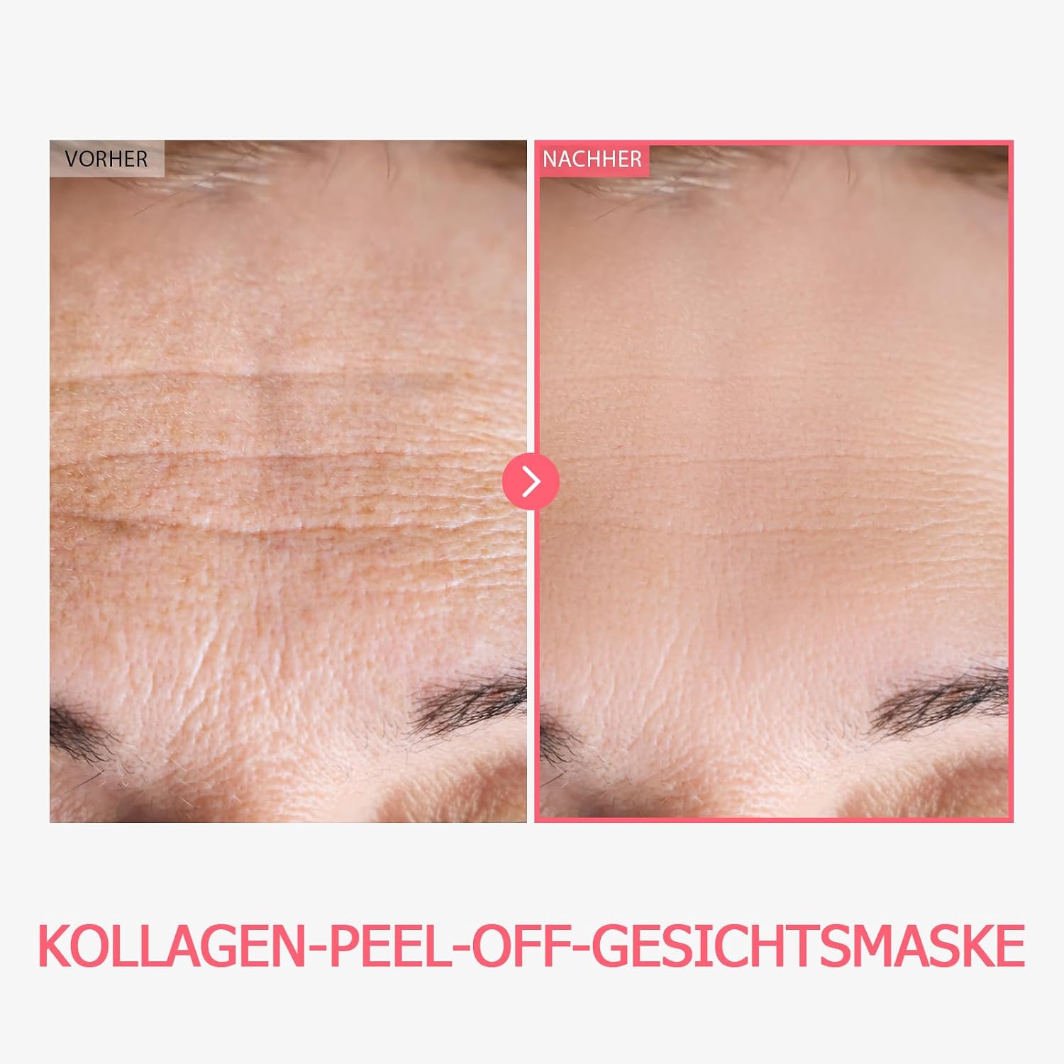 Detalle 2 de TOSOWOONG Real Collagen Fit Kollagenmaske 50ml
