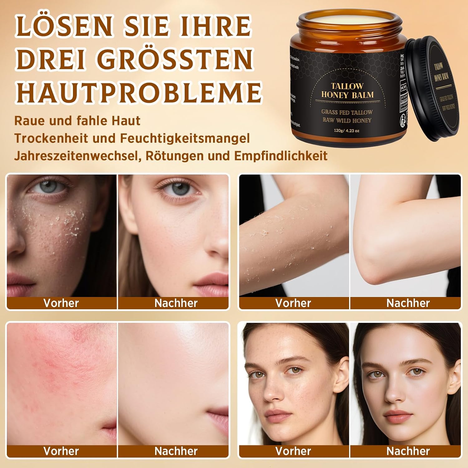 Detalle 2 de Beef Tallow Creme 120g – Rindertalg Feuchtigkeitsbalsam
