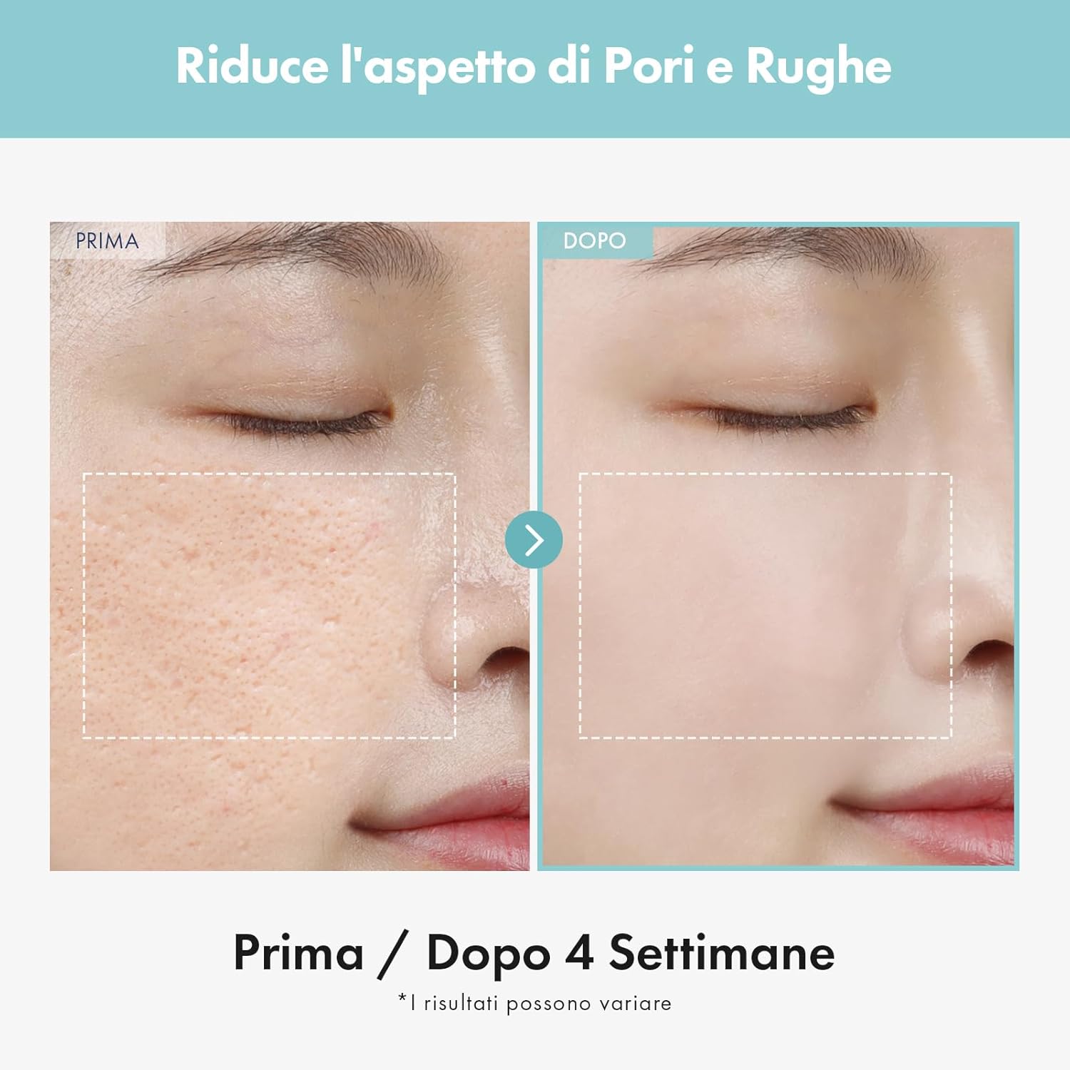 Detalle de TOSOWOONG crema raffinatrice di pori per il viso, riduce e minimizza l’aspetto dei pori (50 g)