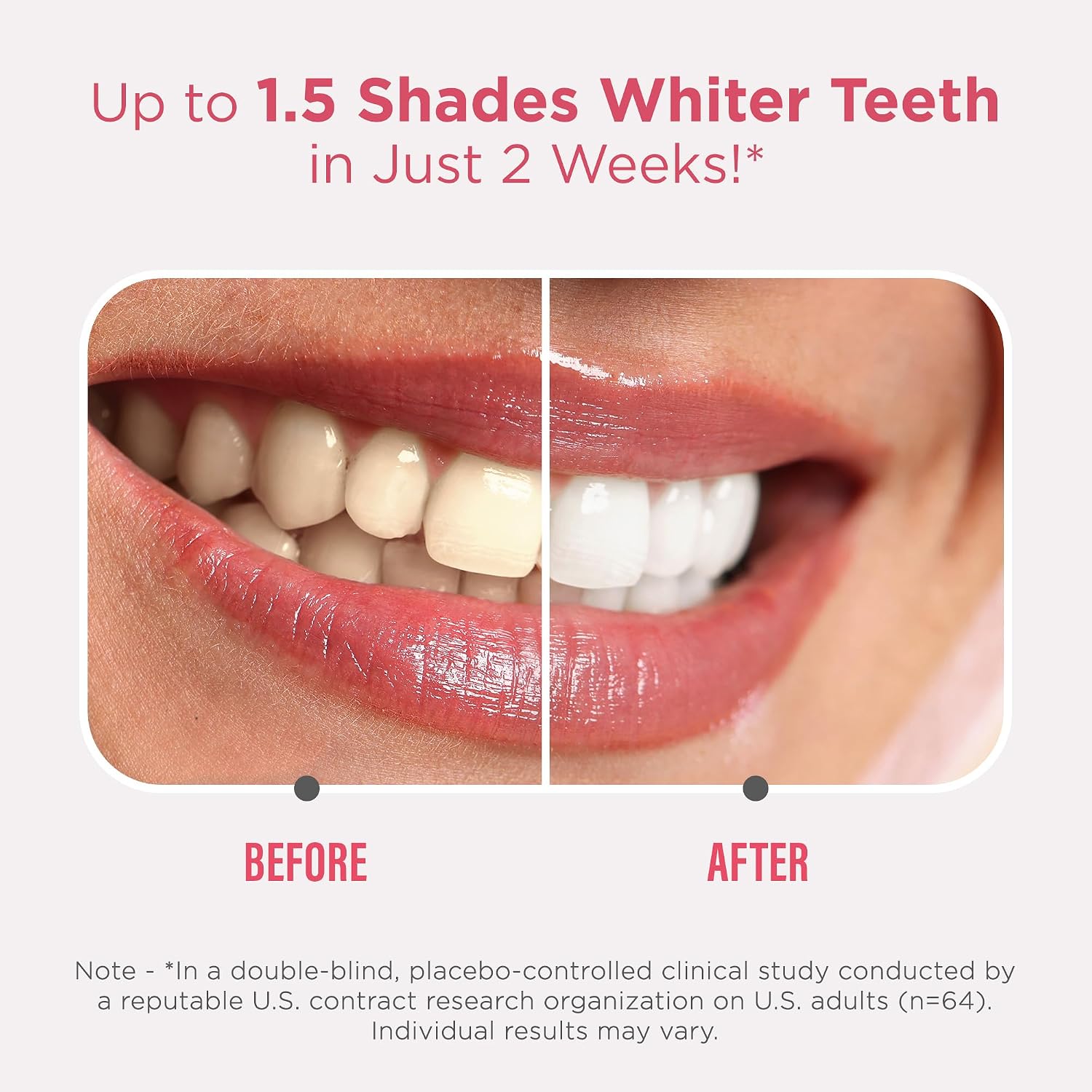 Thumbnail 2 de GuruNanda Sensitive Teeth Whitening Strips — 9-Day Treatment
