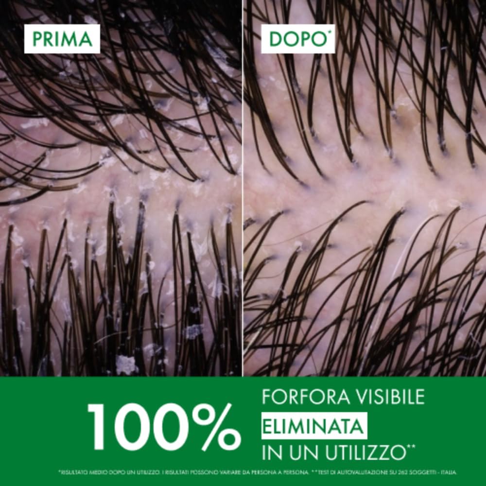 Detalle de Vichy Dercos Eco-Ricarica Shampoo Anti-Forfora DS per Capelli da Normali a Grassi (390 ml)