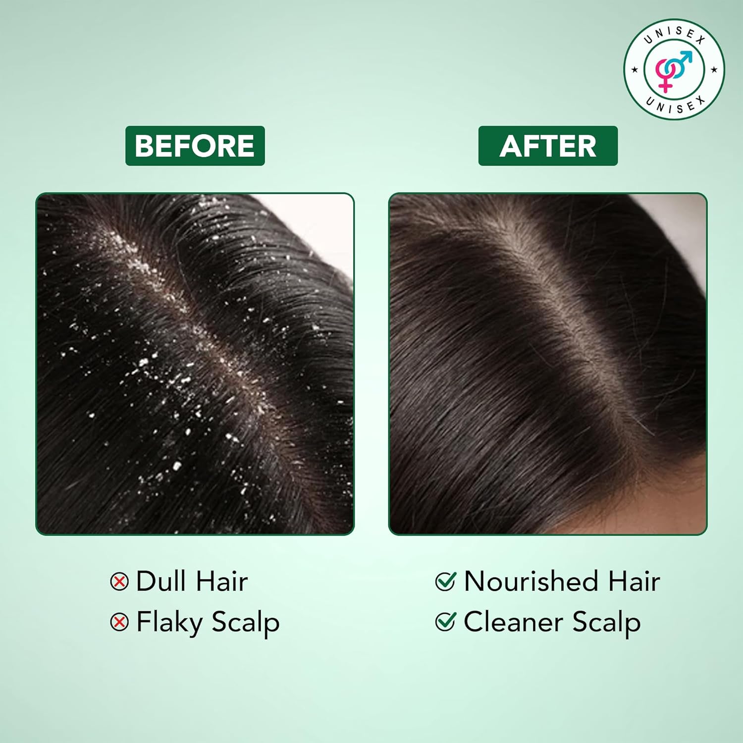 Thumbnail 4 de Botanic Hearth Tea Tree Shampoo and Conditioner Set 16 fl oz