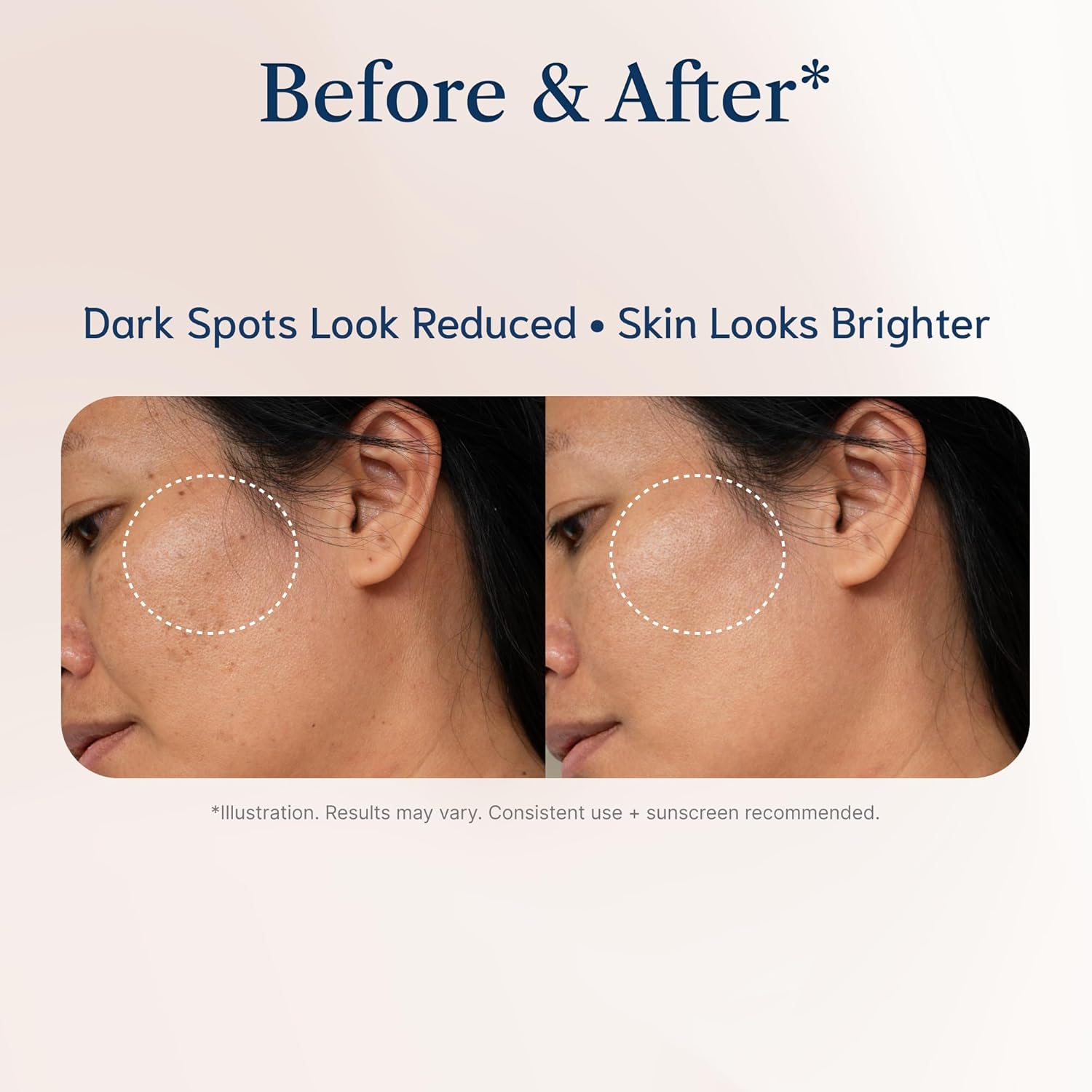 Thumbnail 6 de Dark Spot Remover Niacinamid 30 ml