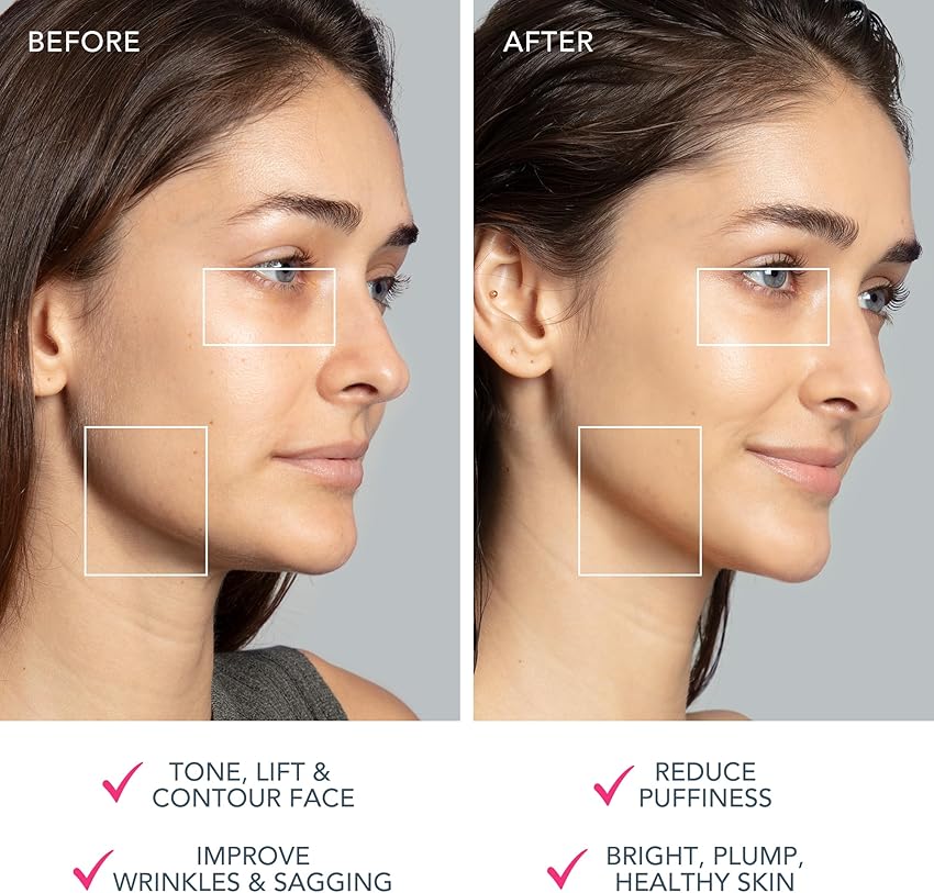 Thumbnail 4 de FOREO BEAR 2 tonificador facial 2.0 fuchsia