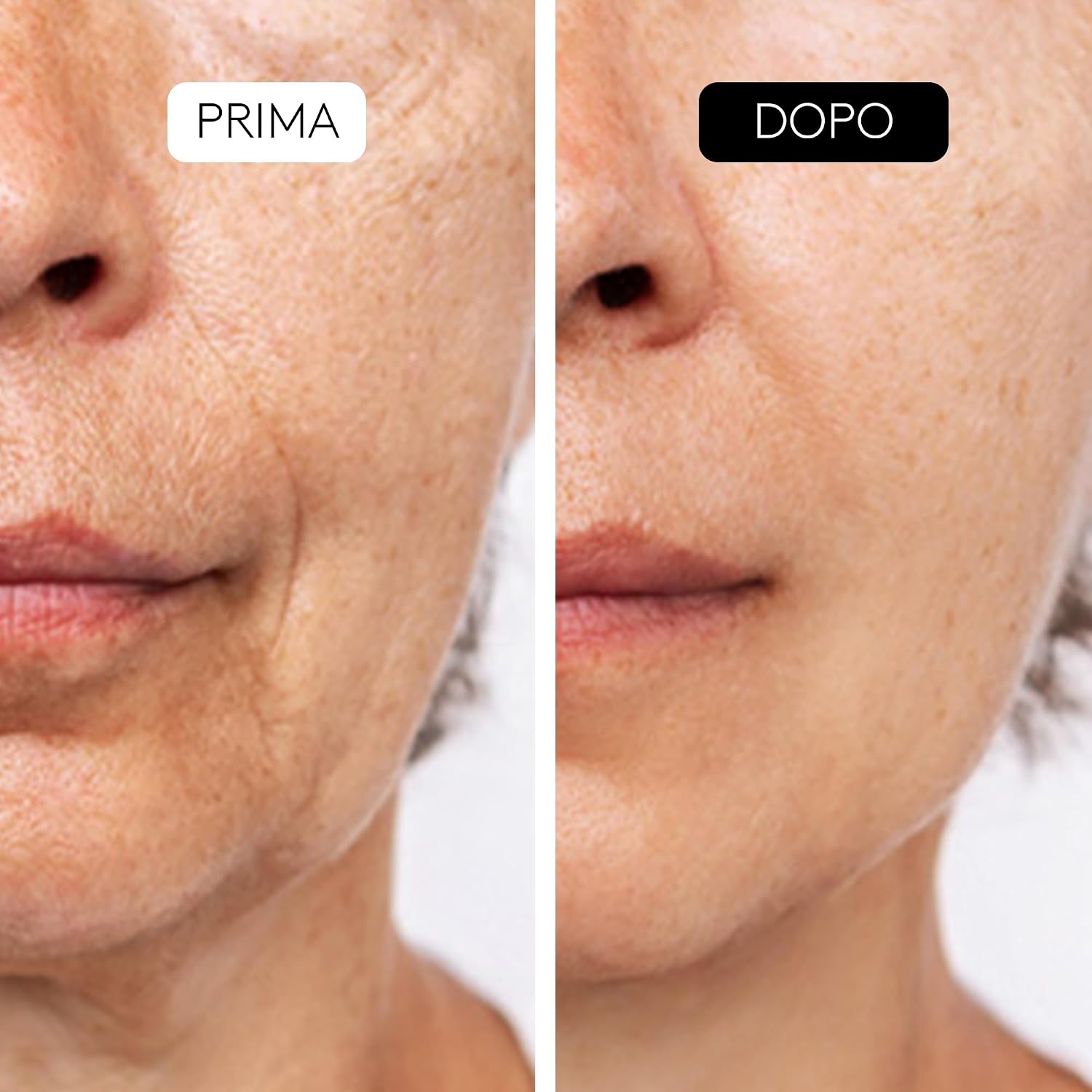 Thumbnail 3 de COCUNAT CLINICAL AHA COMPLEX 10% Triplo siero esfoliante