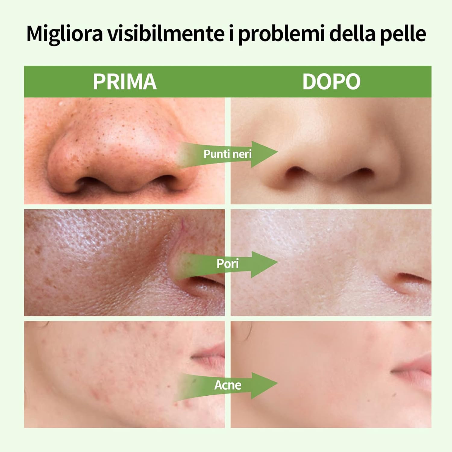 Detalle de ANAiRUi Maschera di fango con Avocado e tè verde – Maschera viso idratante e purificante 120g