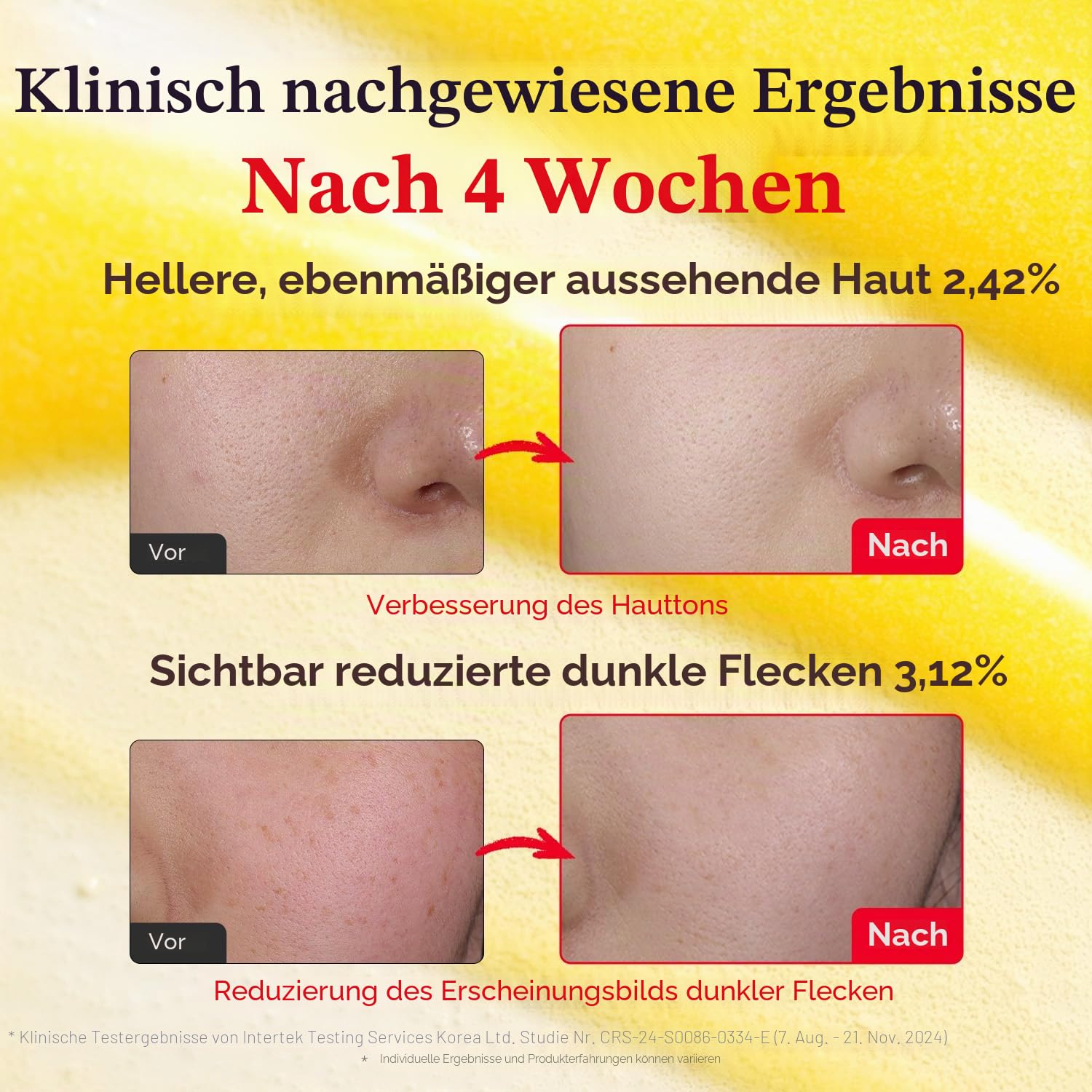 Detalle 2 de EQQUALBERRY Vitamin Illuminating Serum – Serum mit Acerola & Vitamin C, helleres Hautbild, Niacinamid & Ceramide, Hyaluron – 30 ml