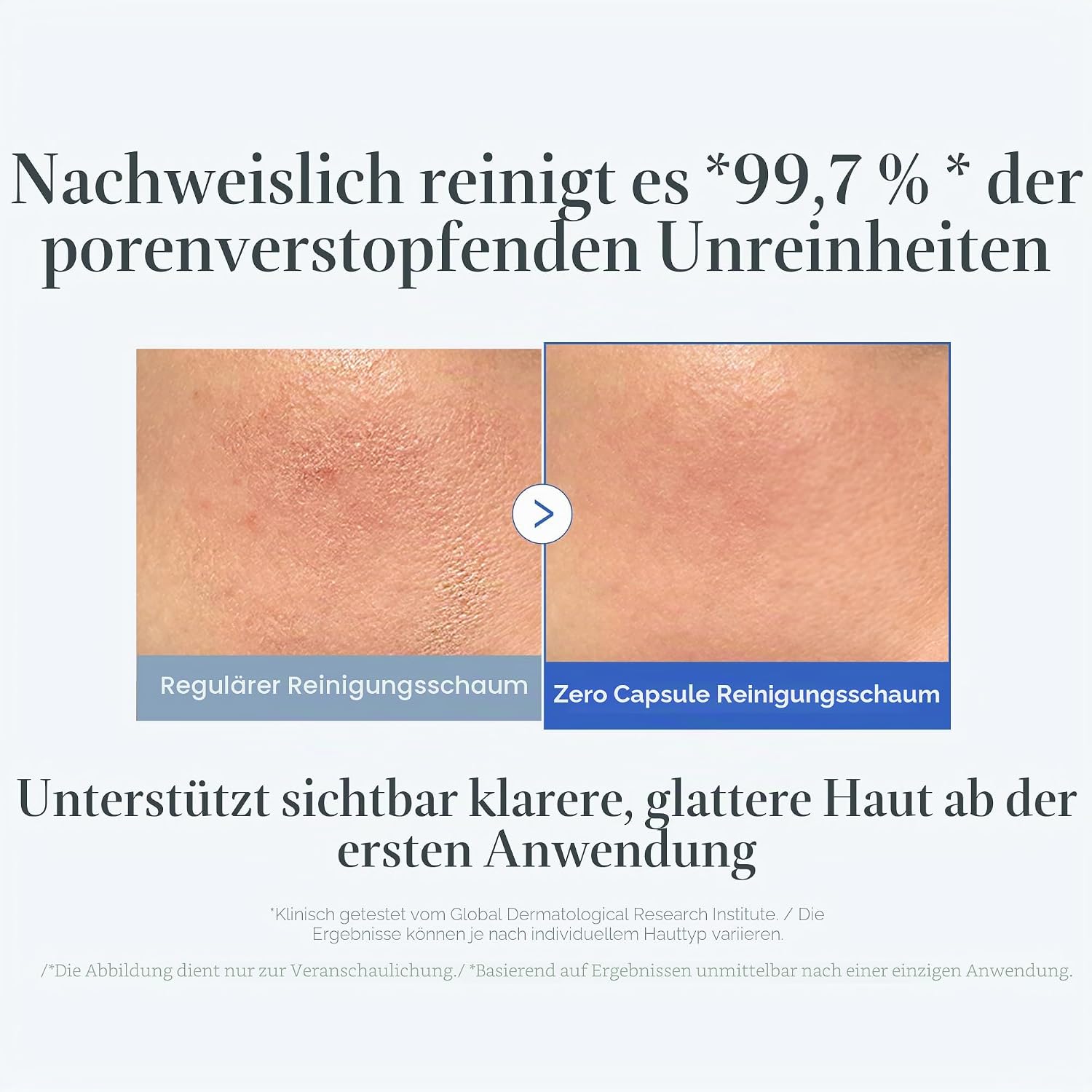 Detalle de Medicube Zero Pore Clear Blue Capsule Cleanser – Sanfter Schaumsreiniger mit AHA, BHA & PHA