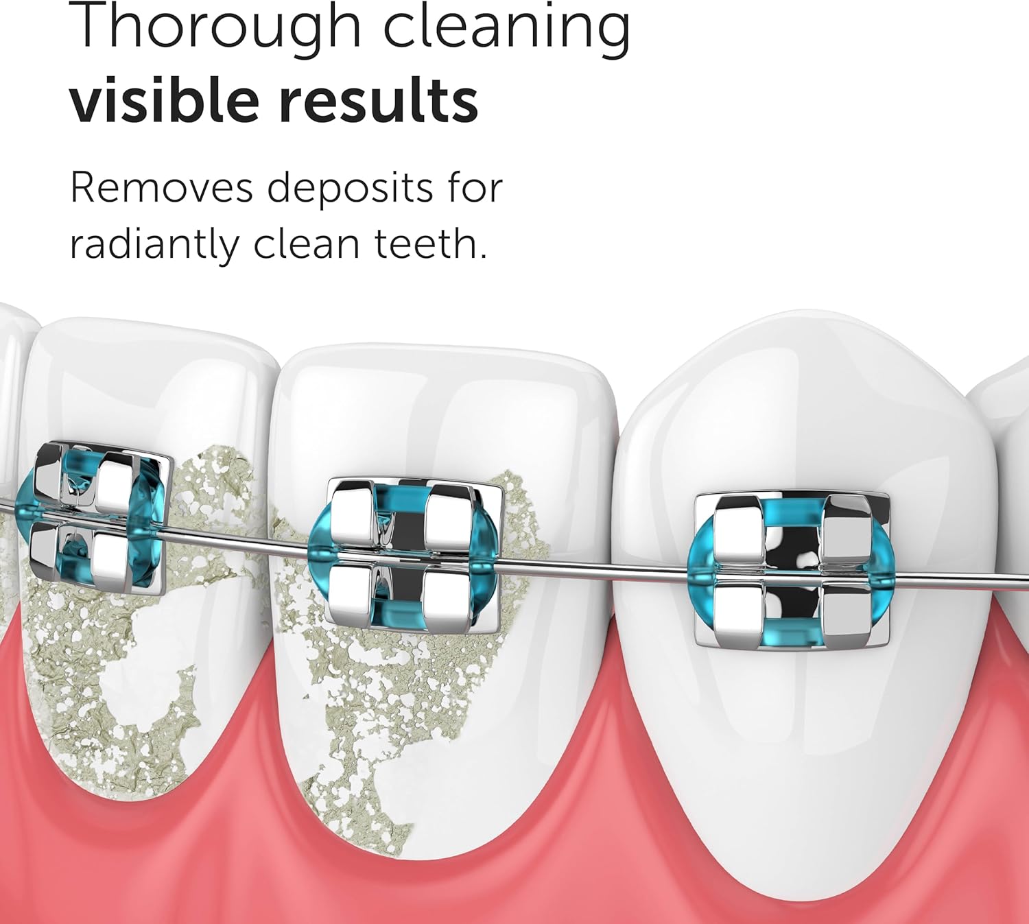 Thumbnail 2 de Waterflow Nozzles 4 pack for gum care