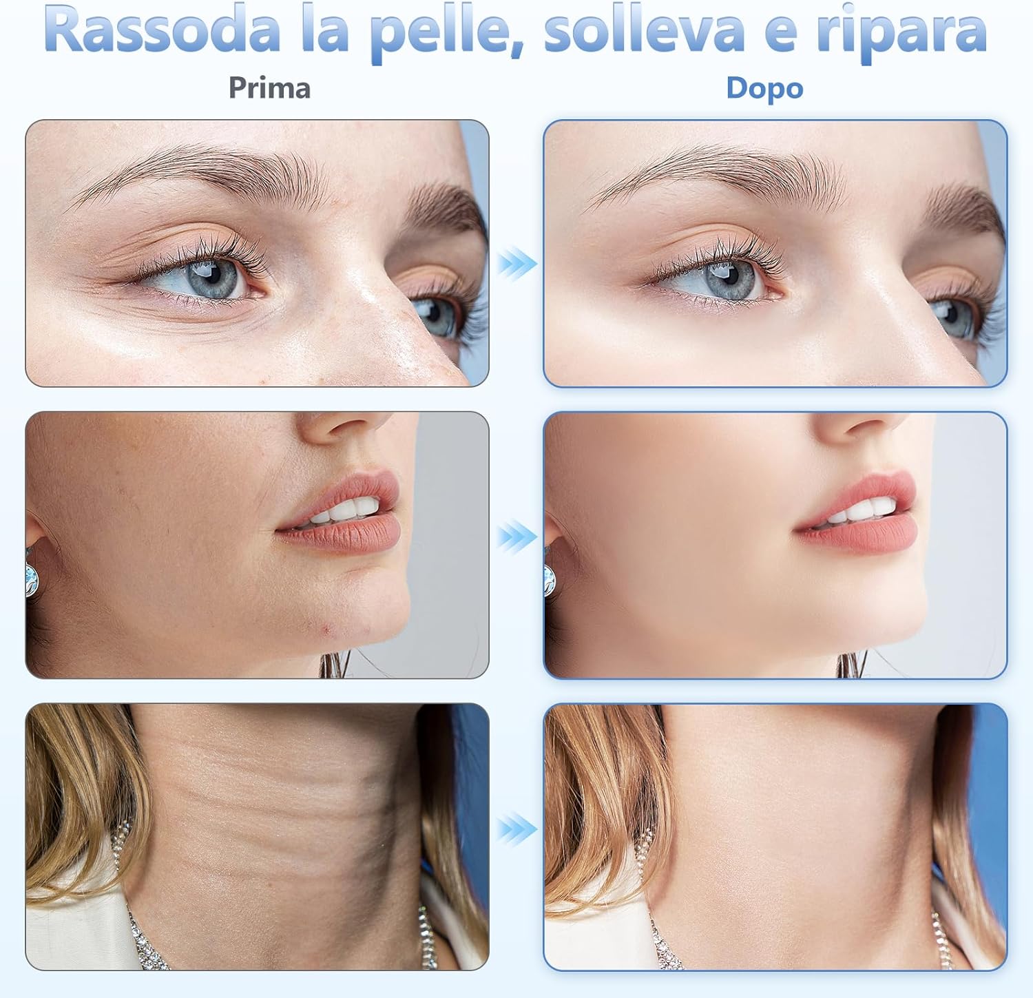 Thumbnail 2 de Massaggiatore Viso Lifting 6 modalità 45°C
