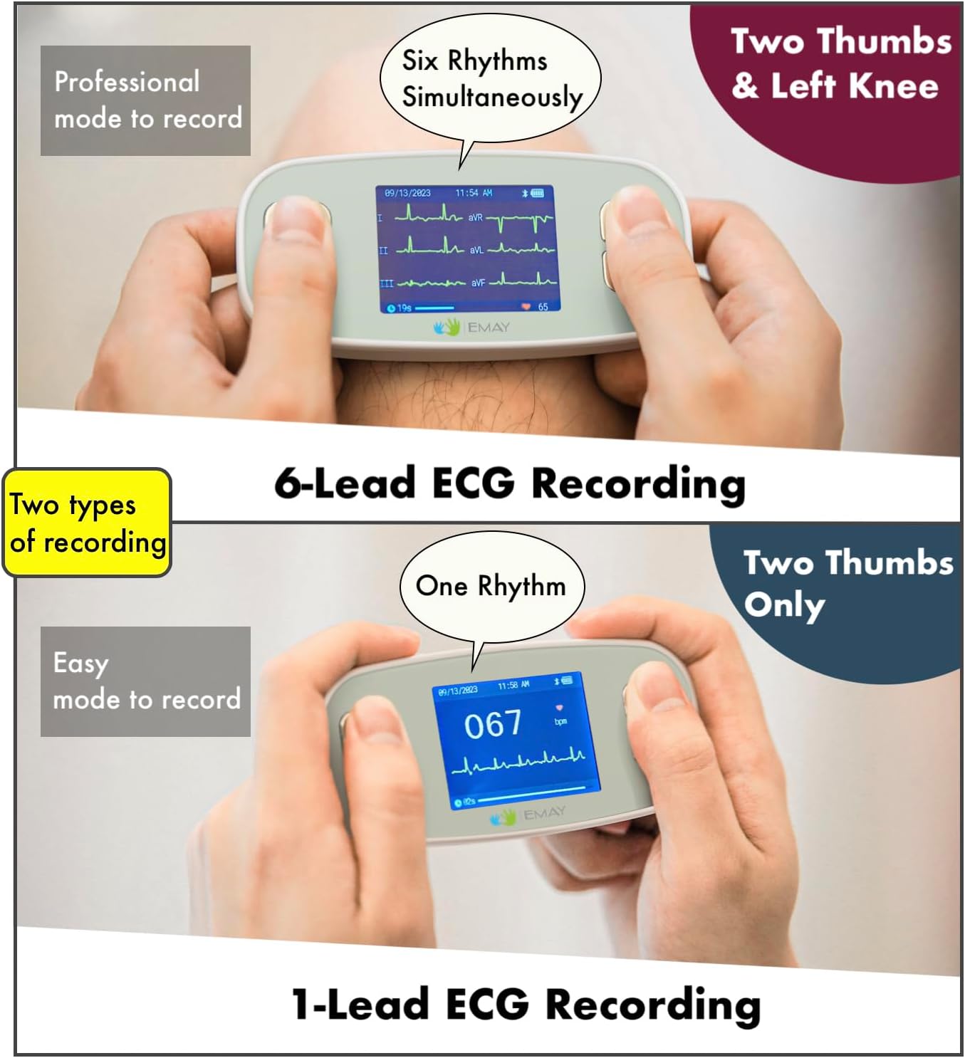 Thumbnail 4 de EMAY 6L Portable ECG Monitor 6L