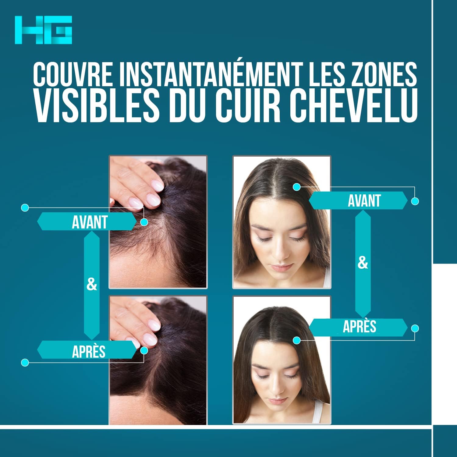 Thumbnail 4 de Hair Genetics Retouche-Racines – Noir: Retouche rapide pour cacher les cheveux gris
