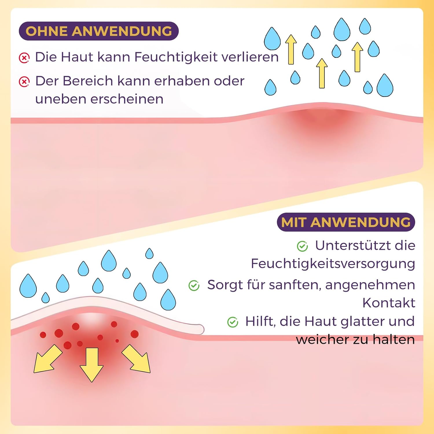Detalle de Silikon Narbenpflaster 4 cm × 300 cm – wiederverwendbar, hautfarben, wasserdicht und atmungsaktiv