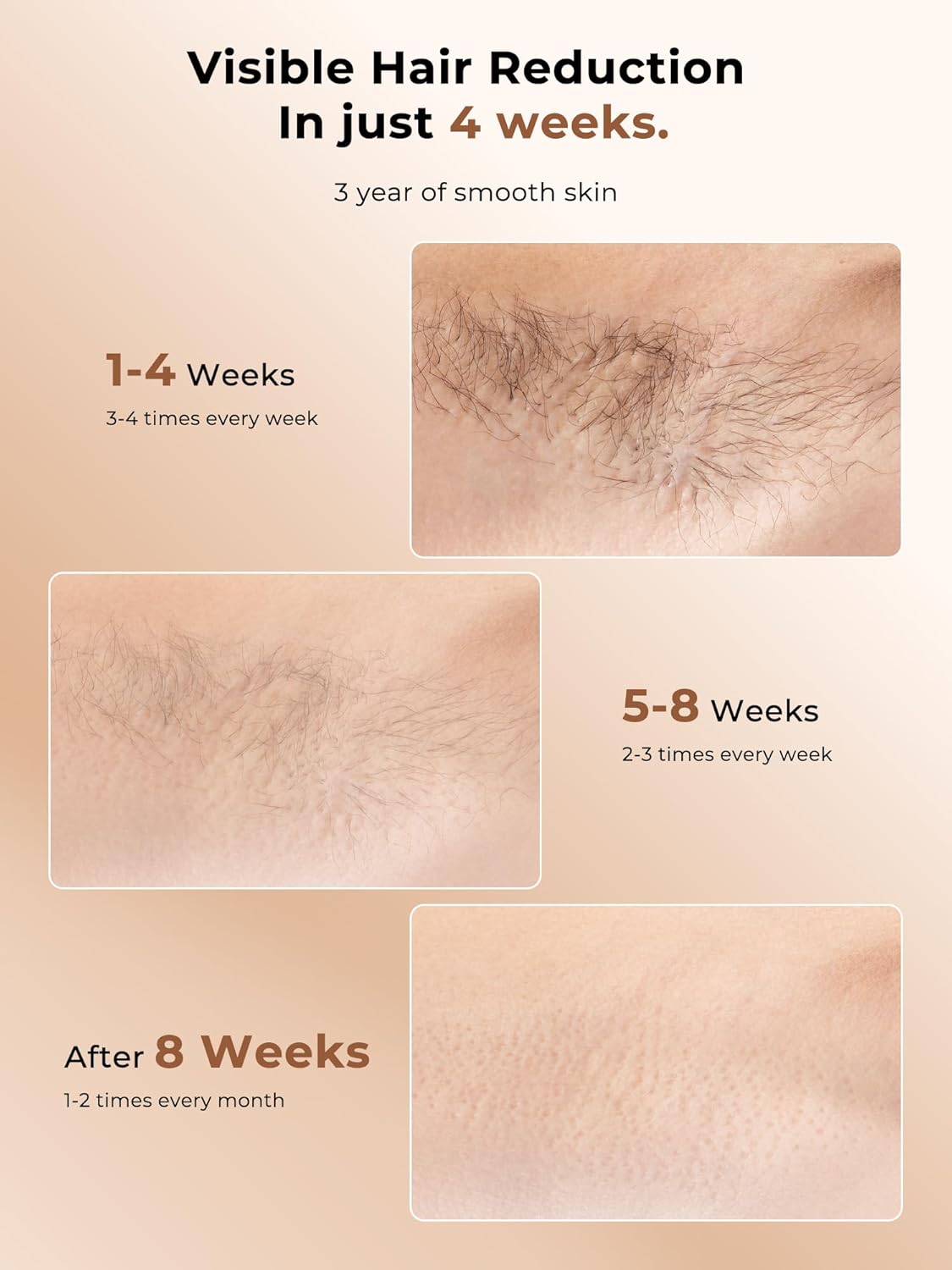 Detalle 2 de Ubroo Laser Hair Removal IPL Device with 5℃ Ice Cooling (Gold) for Men & Women