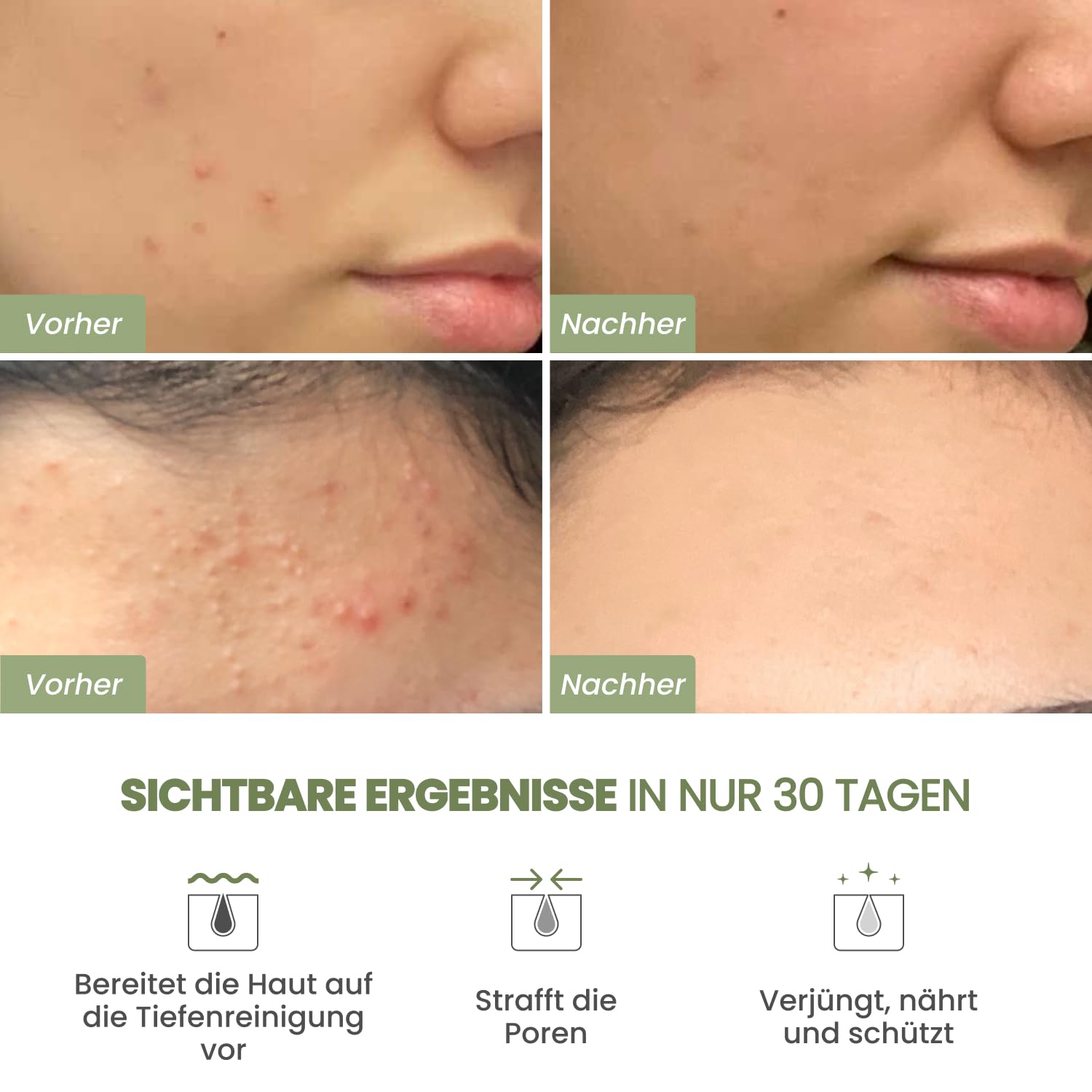 Thumbnail 1 de PLANTIFIQUE Koreanische Gesichtsmaske 100g