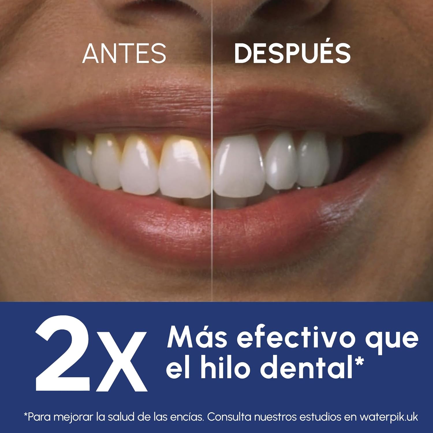 Thumbnail 3 de Waterpik Ultra WP-660EU: Irrigador Dental Profesional Blanco 💧