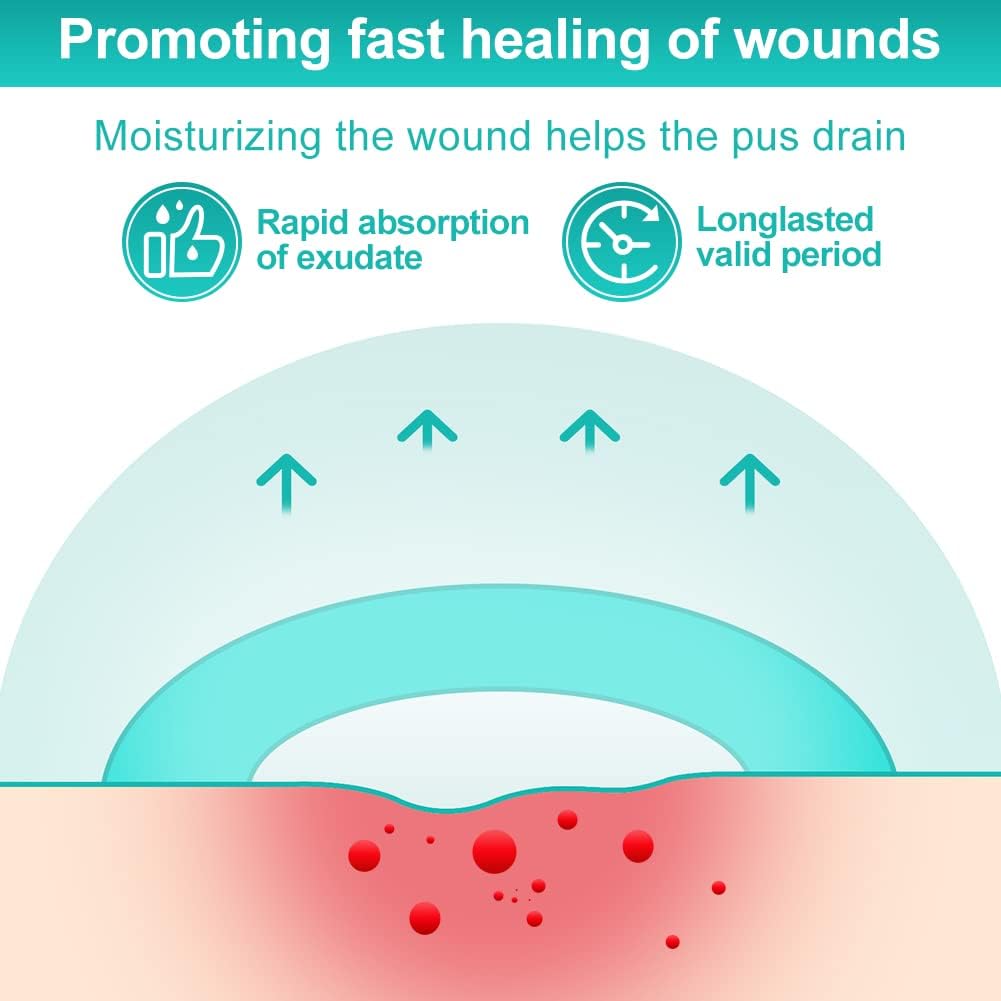 Thumbnail 1 de Dimora Hydrocolloid Dressing – Waterproof, Self-Adhesive Wound Patches (7.5cm x 7.5cm) – 10 Pack