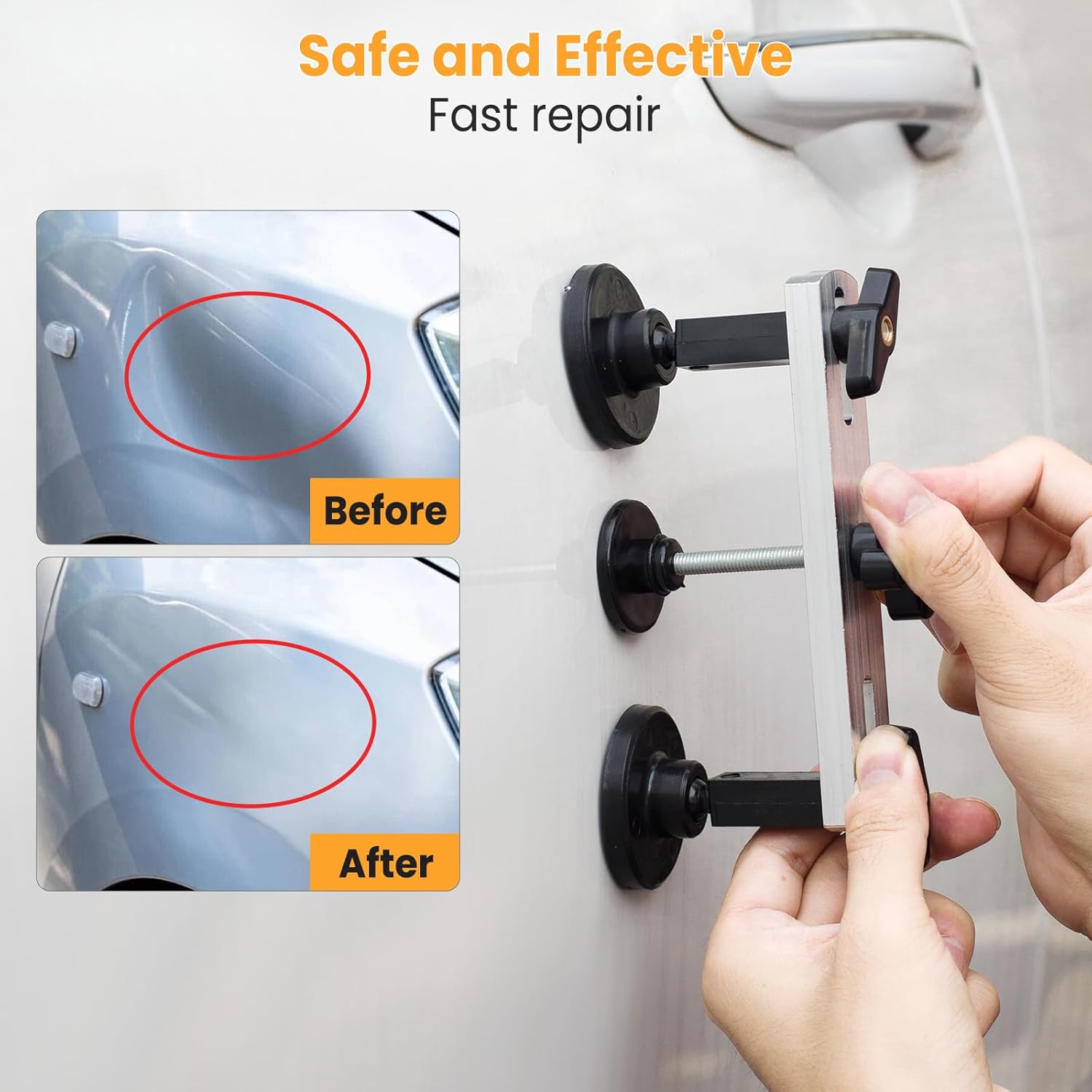 Thumbnail 5 de Sigoobal Car Dents Removal Kit, 135 Pieces ⚙