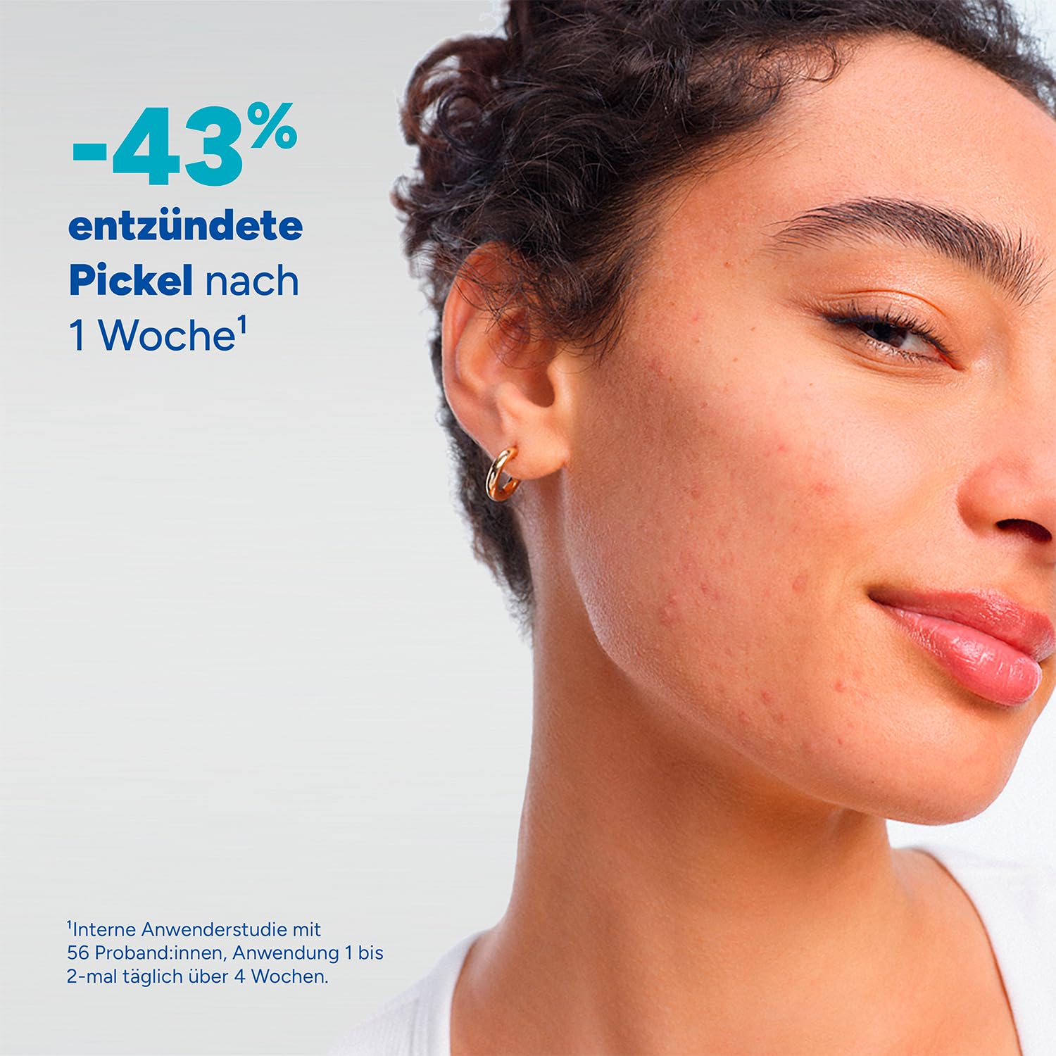 Thumbnail 2 de DUCRAY Keracnyl Schäumendes Waschgel – Reinigung für fettige, zu Akne neigende Haut (ab 9 Jahren), 400 ml