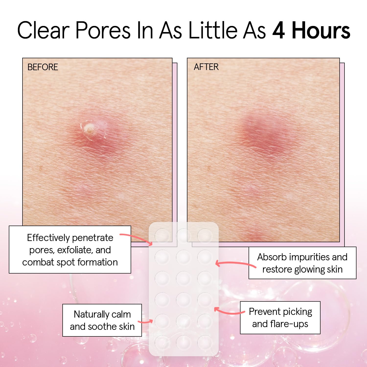Thumbnail 2 de Grace & Stella Pore Strip Pimple Patches