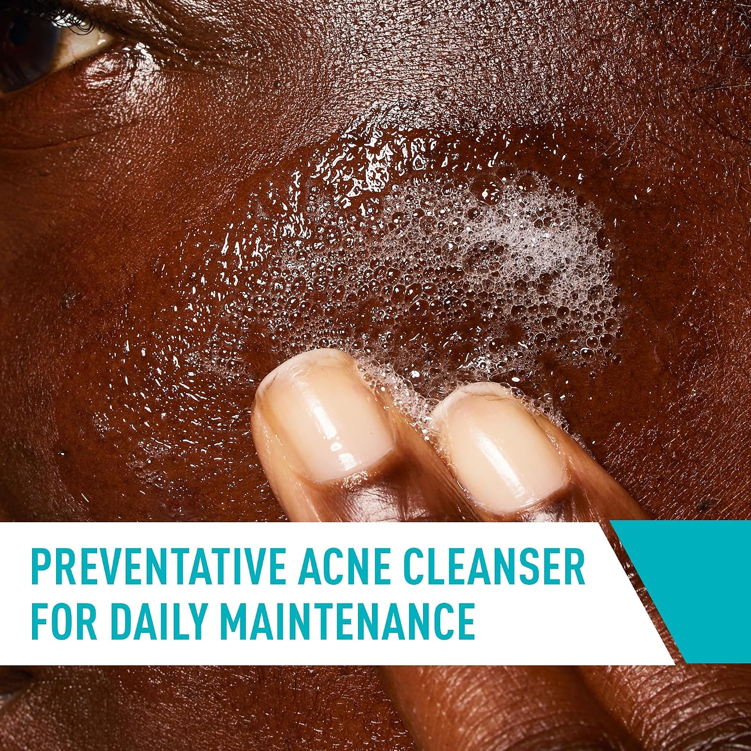 Thumbnail 3 de CeraVe Acne Control Cleanser with 2% Salicylic Acid — 16 oz