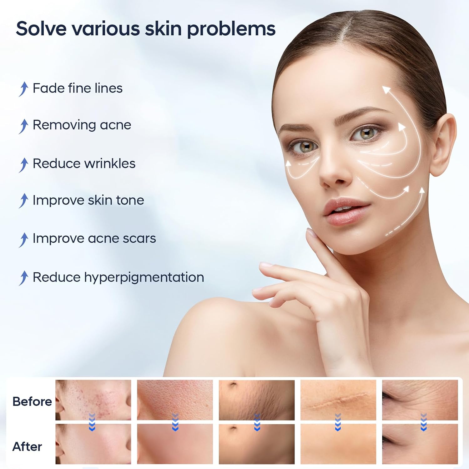 Thumbnail 5 de Dr. Pen A11 Microneedling Pen – kabelloses Induktionsgerät mit 6 Geschwindigkeiten & 18-Nadel-Patrone (2 Patronen)