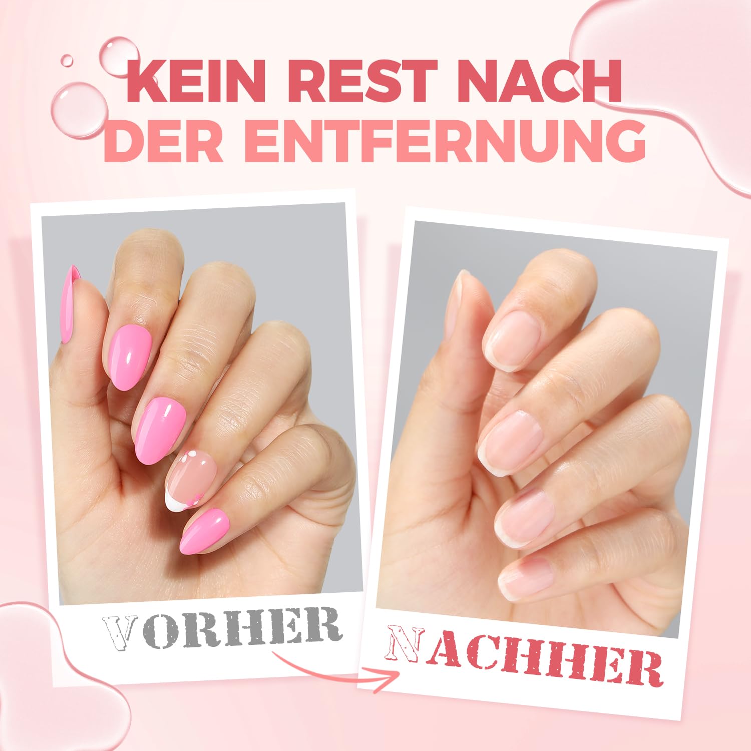 Detalle 2 de UNA GELLA Nagelkleber Entferner für Press On Nails – acetonfrei, 30 ml, mit integriertem Hebel