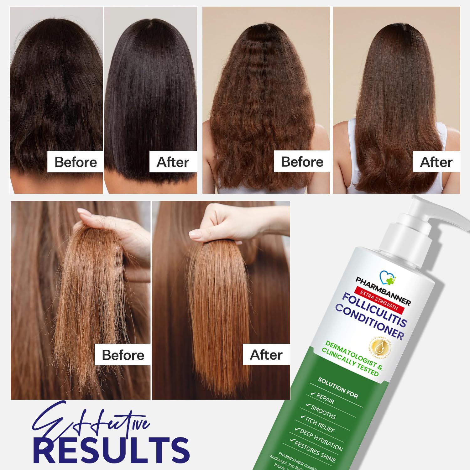 Thumbnail 2 de PHARMBANNER Folliculitis Itch Relief Conditioner with Tea Tree Oil & Moroccan Argan Oil