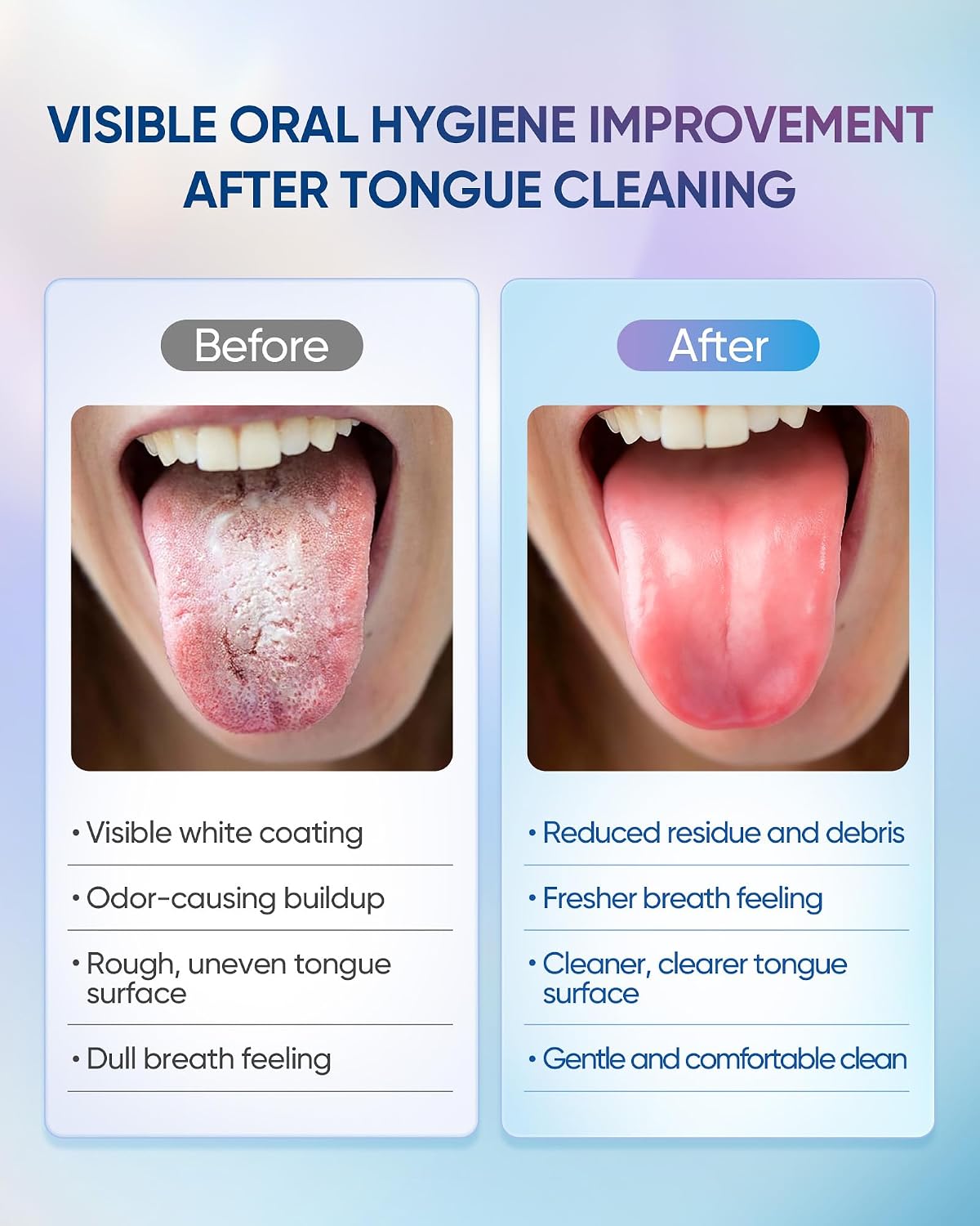 Detalle 2 de BodyAccel Tongue Cleaner Gel with Tongue Brush – Fresh Breath Oral Care Kit