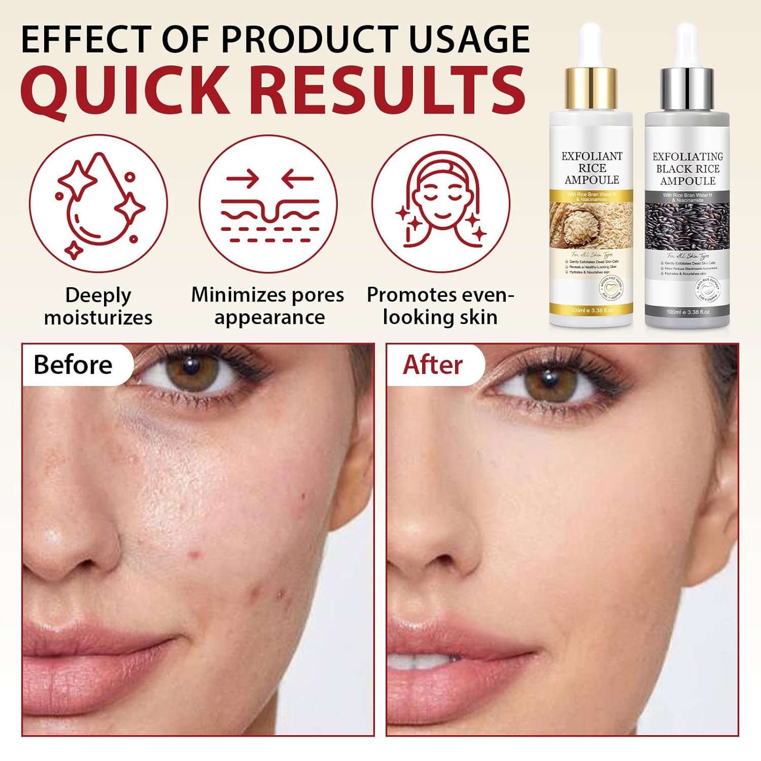 Thumbnail 4 de Furnrubden Peel Shot Glow Rice Ampoule Duo