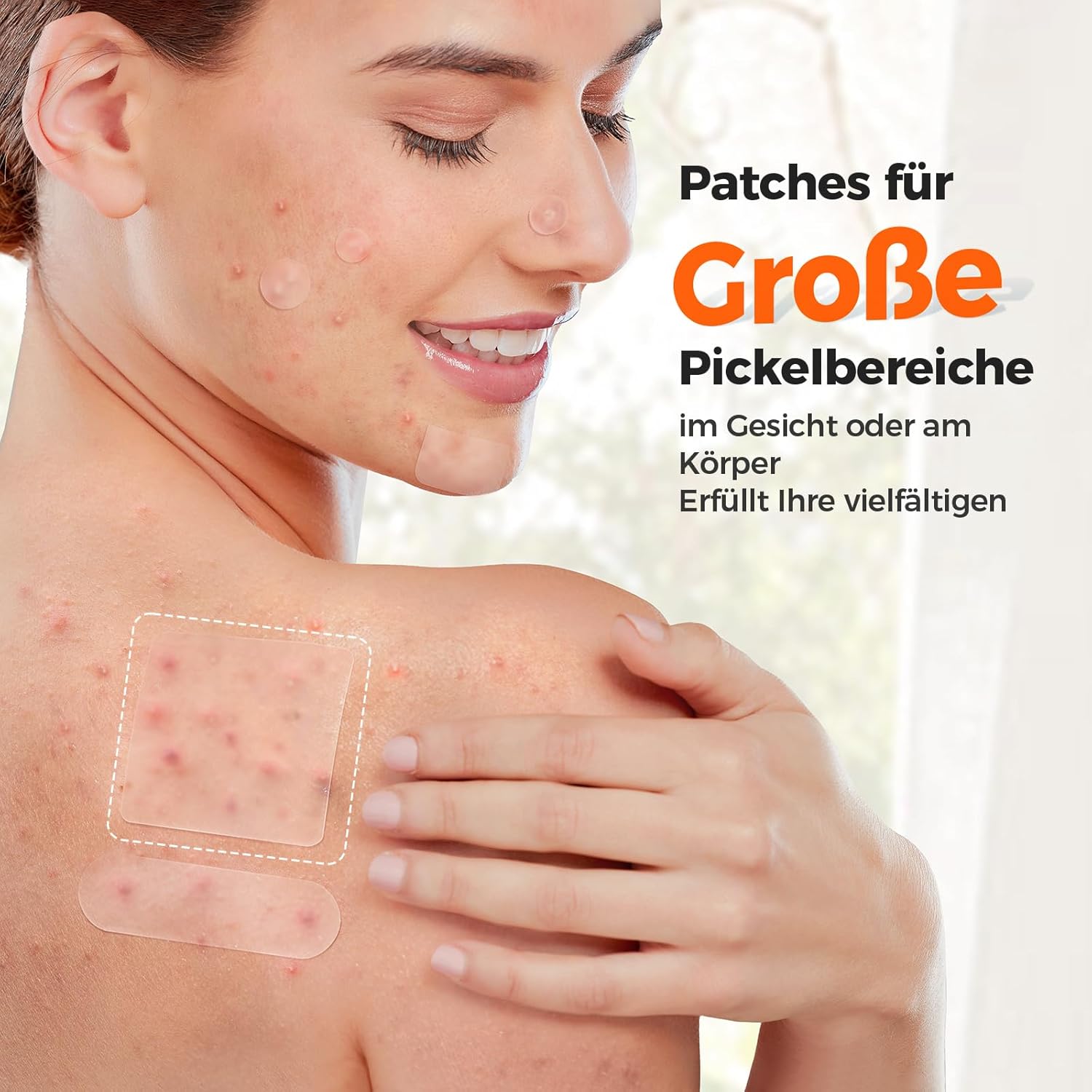 Detalle de TKTK Pickel Patch für Gesicht – XL Hydrocolloid-Patches (270 Stück)