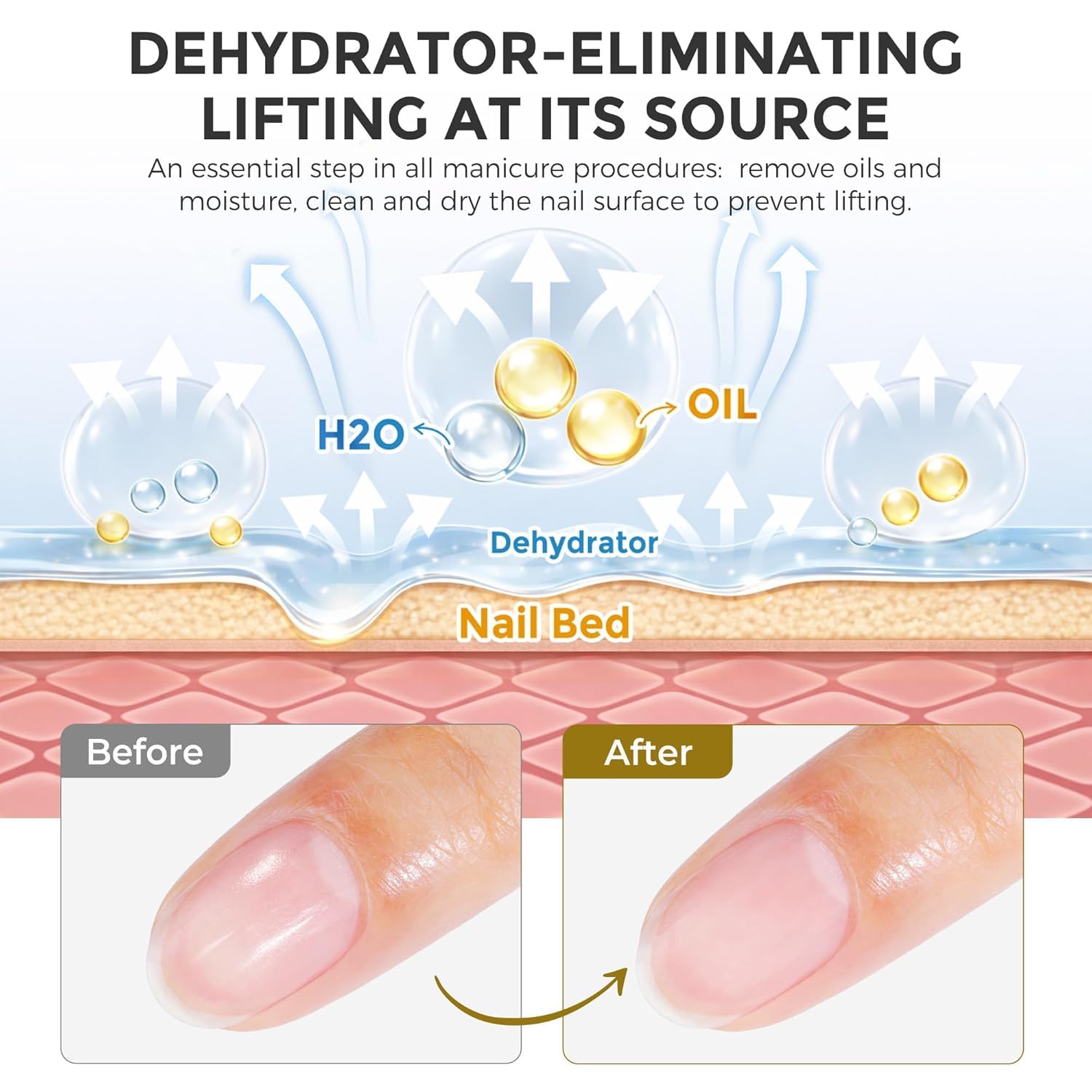 Detalle de UNA GELLA Nail Primer & Nail Prep Dehydrator Set (10 ml) für Press-on, Acryl und Gel-Lack – Haftvermittler mit Anti-Lifting-Effekt