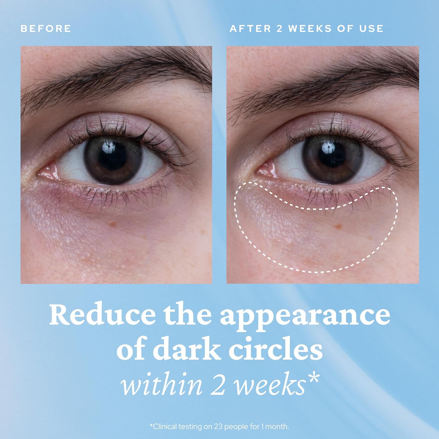 Detalle de belif Aqua Bomb Cooling Eye Gel: gels a base di caffeina e acido ialuronico per occhi freschi
