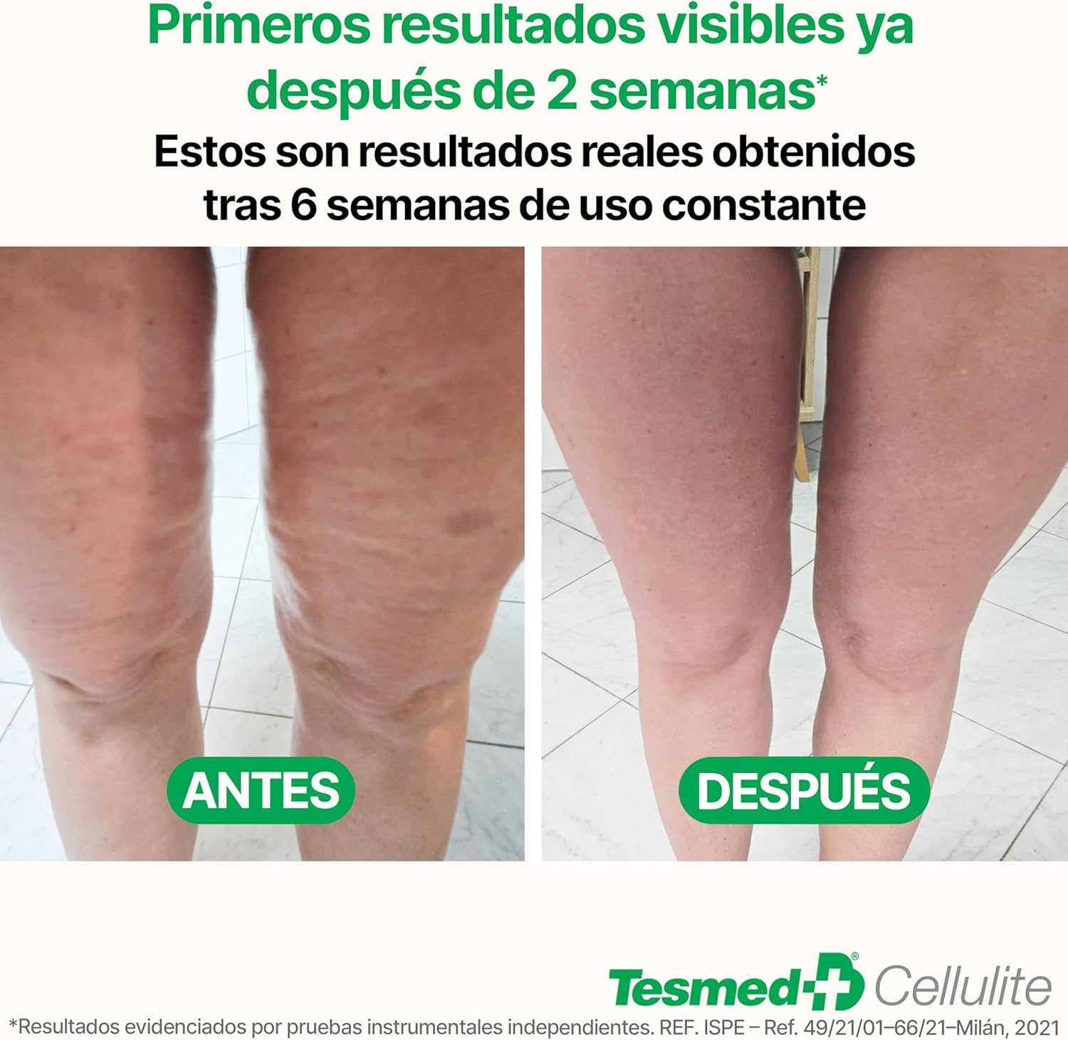 Detalle 2 de TESMED Masajeador Anticelulítico Reductor 9–38 cm