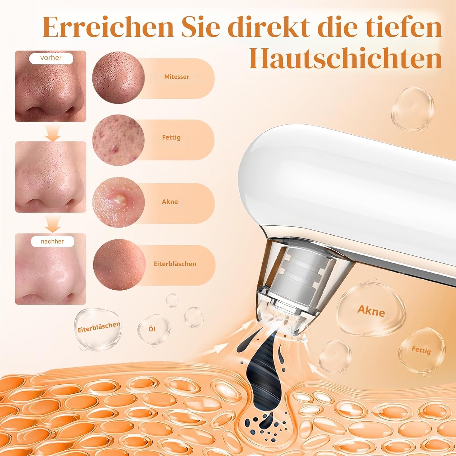 Detalle de Yccu Mitesserentferner Porensauger Gesichtsreiniger