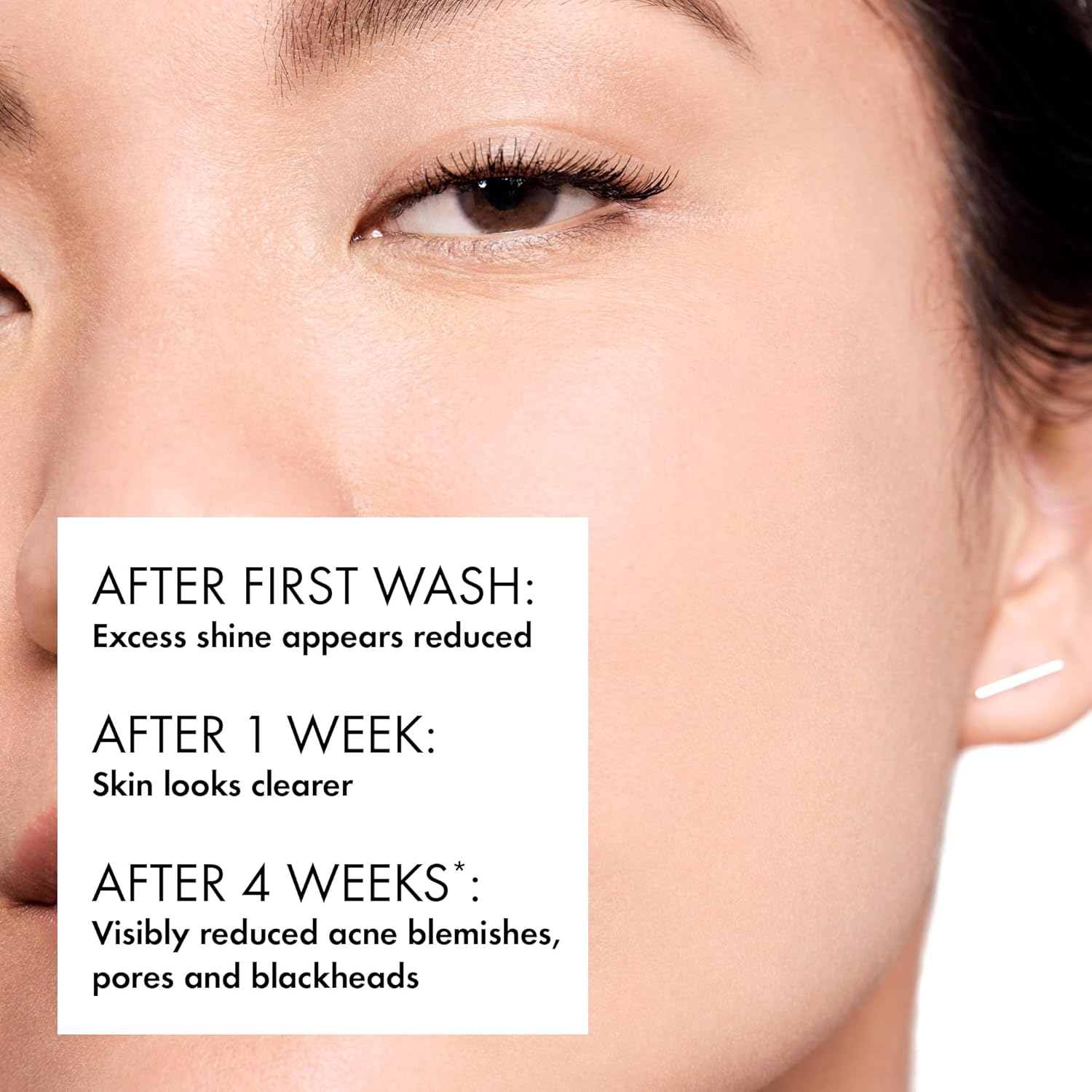 Thumbnail 5 de Vichy Normaderm Intensive Purifying Cleanser for Blemish‑Prone Skin (200ml)