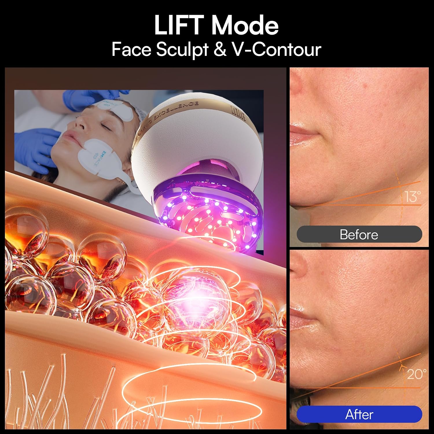 Thumbnail 4 de INIA SPHERA INIA-BD002 Microcurrent Facial Device with Red LED, Heat and Cooling