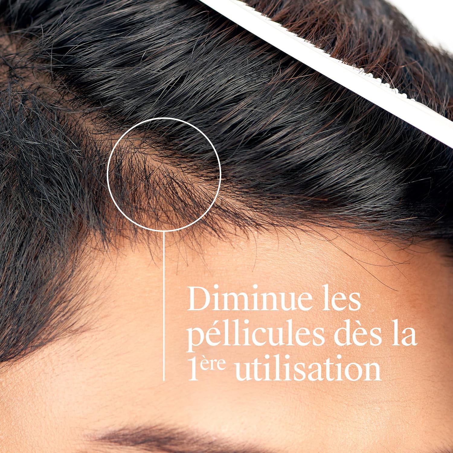 Detalle de Neutrogena Shampoing T/Gel Fort Fort anti-démangeaisons et pellicules (250 mL)